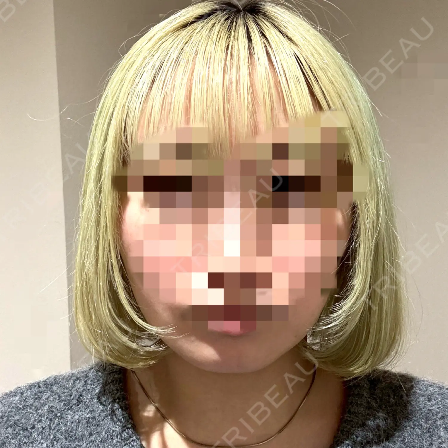 施術前の写真