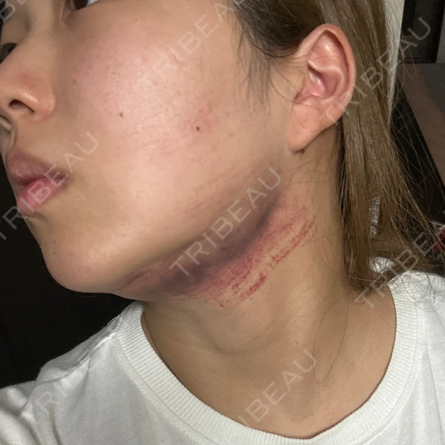 施術前の写真