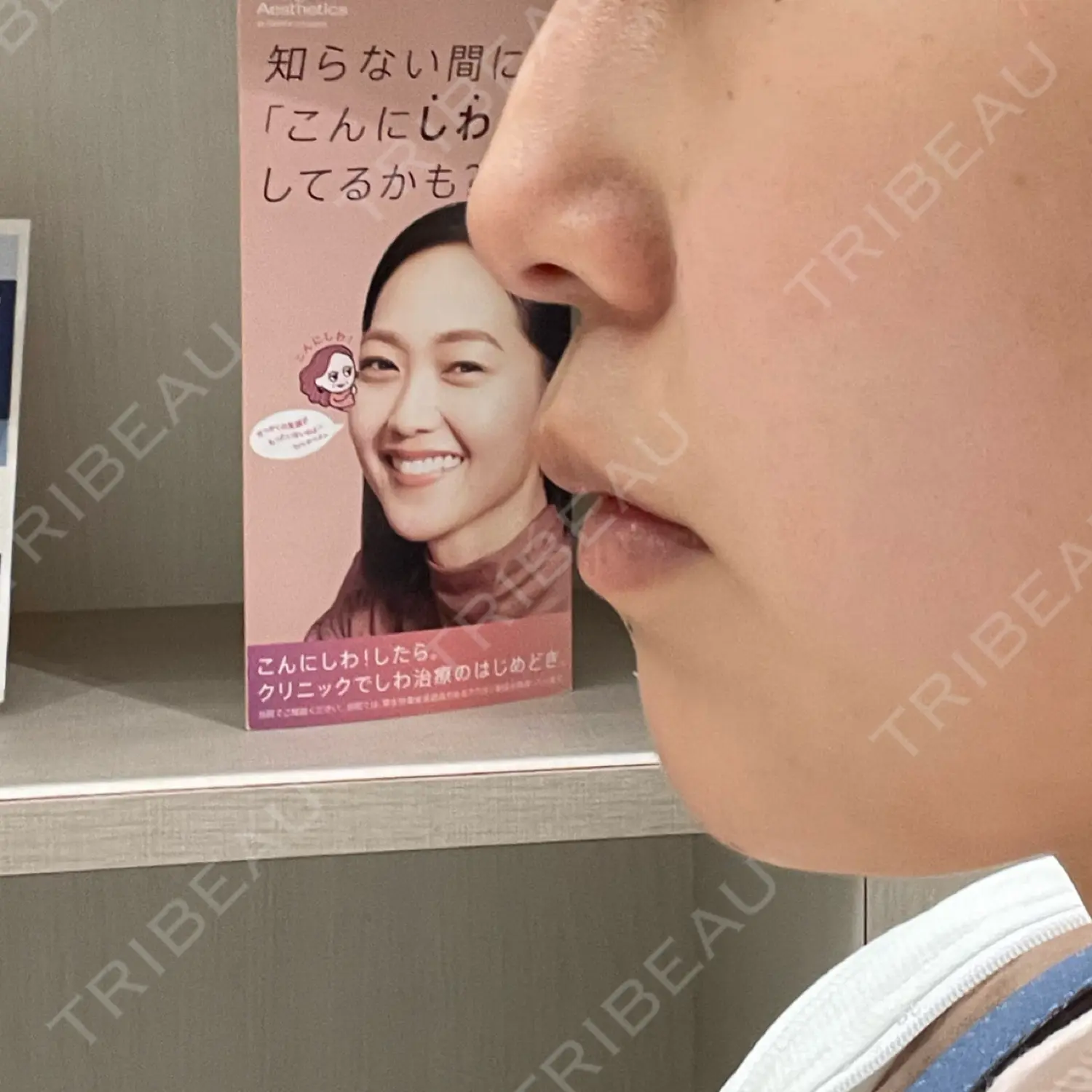 施術前の写真