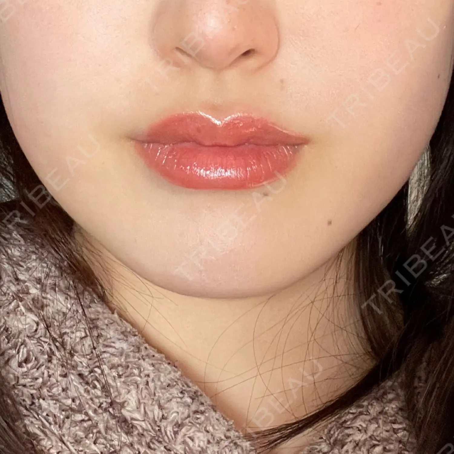 施術前の写真