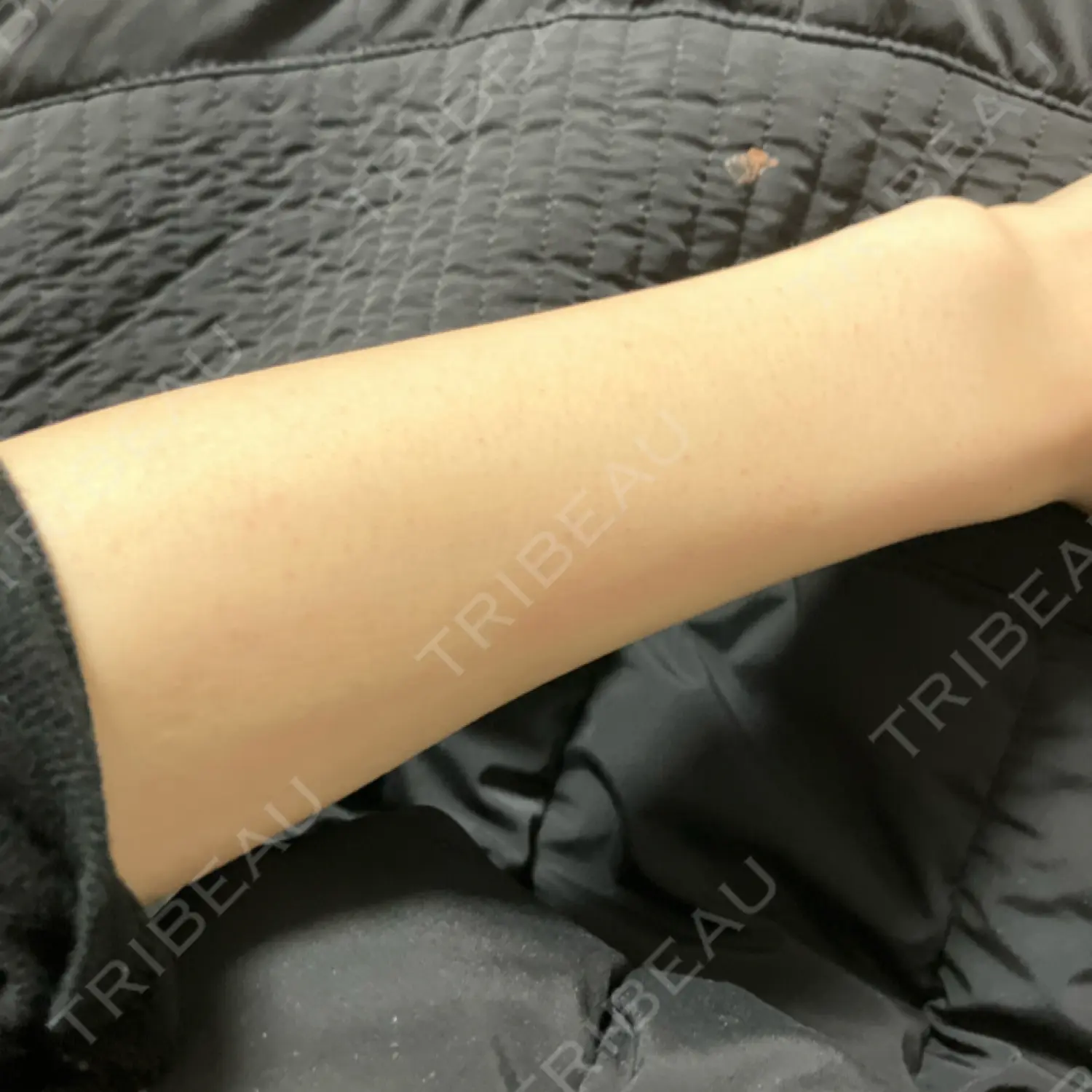 施術前の写真