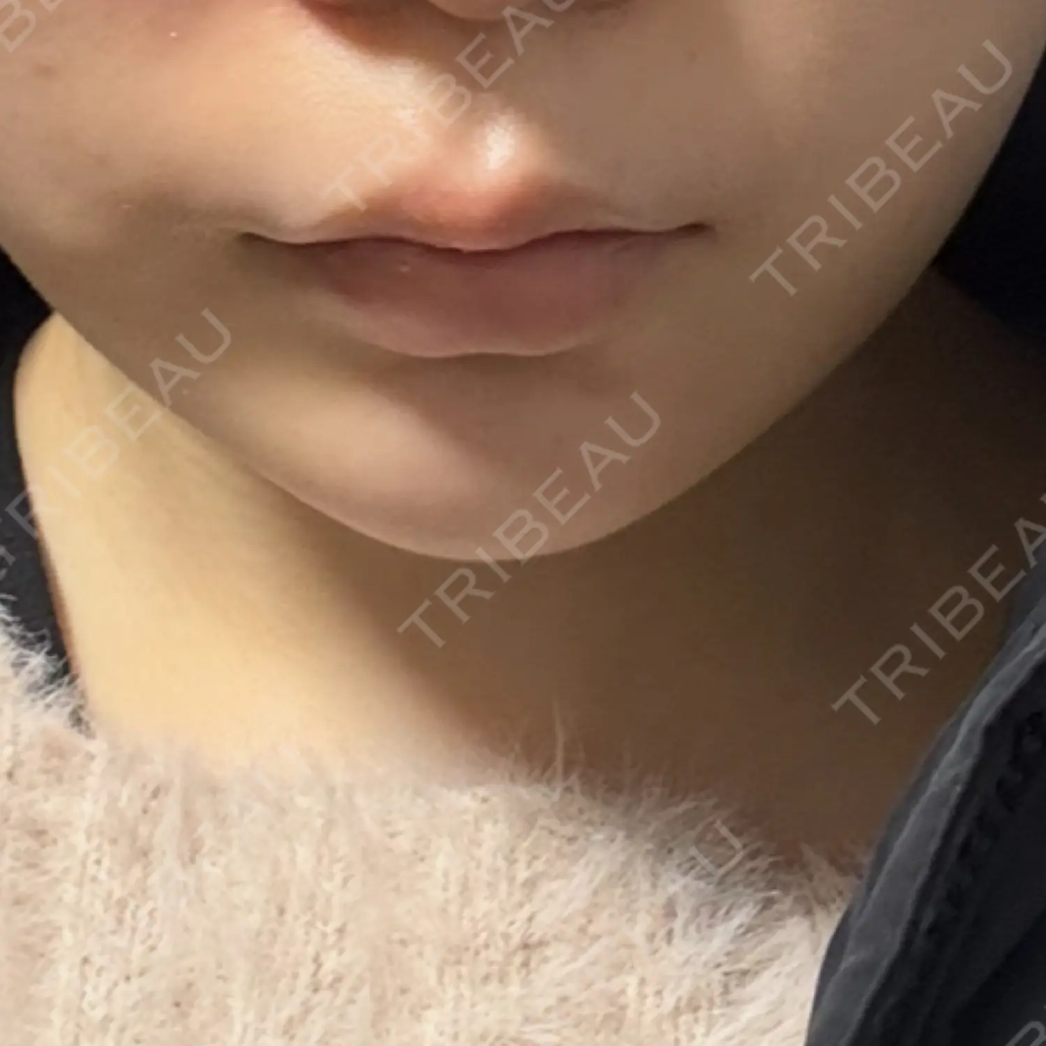 施術前の写真