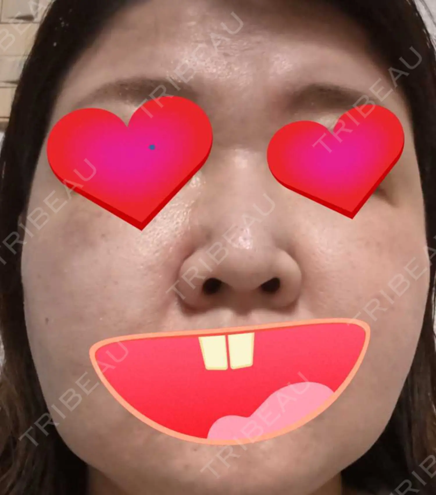 施術前の写真