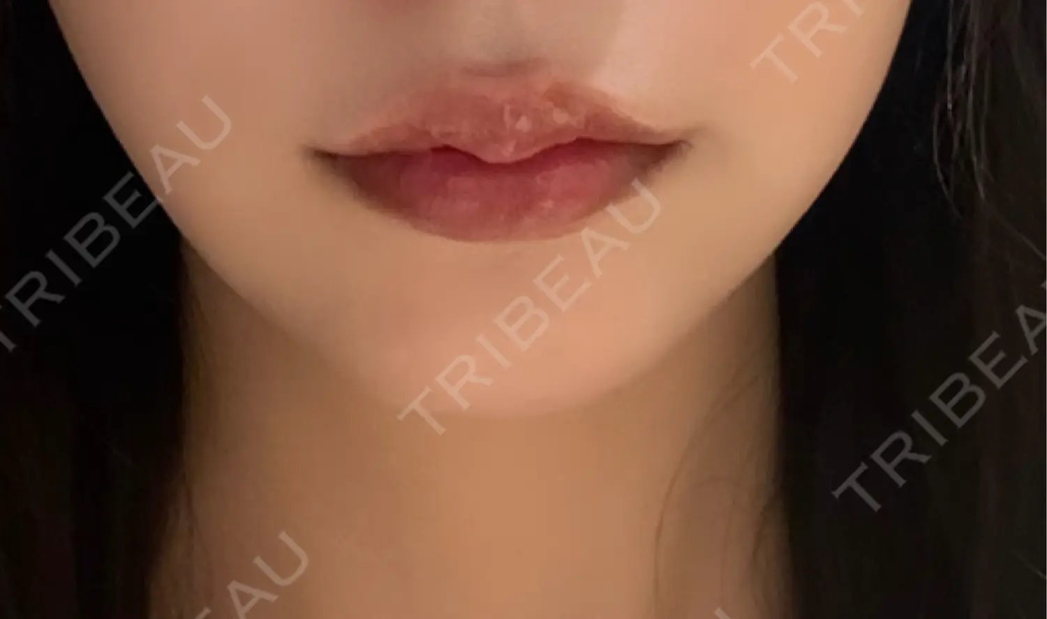 施術前の写真