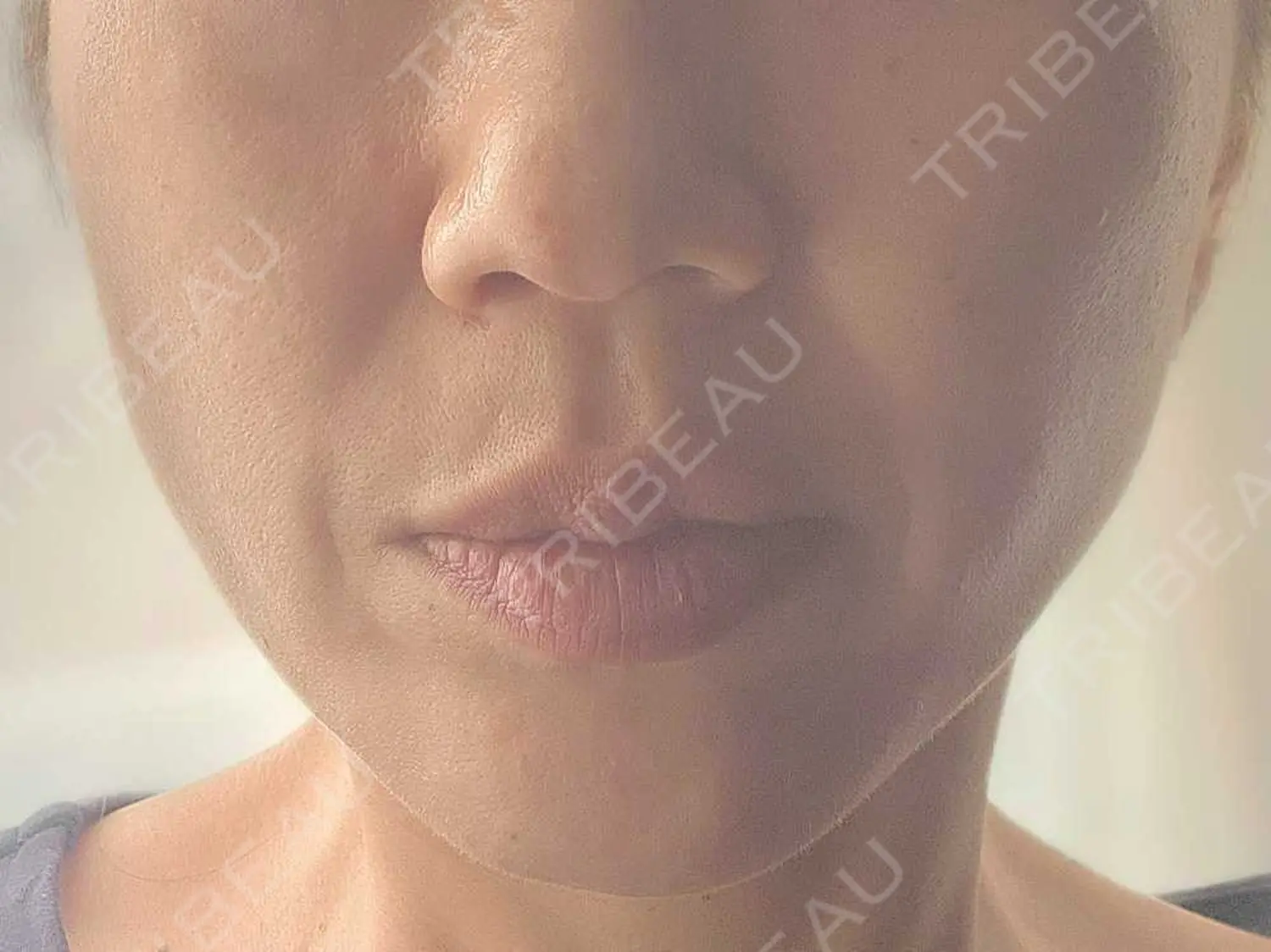 施術前の写真