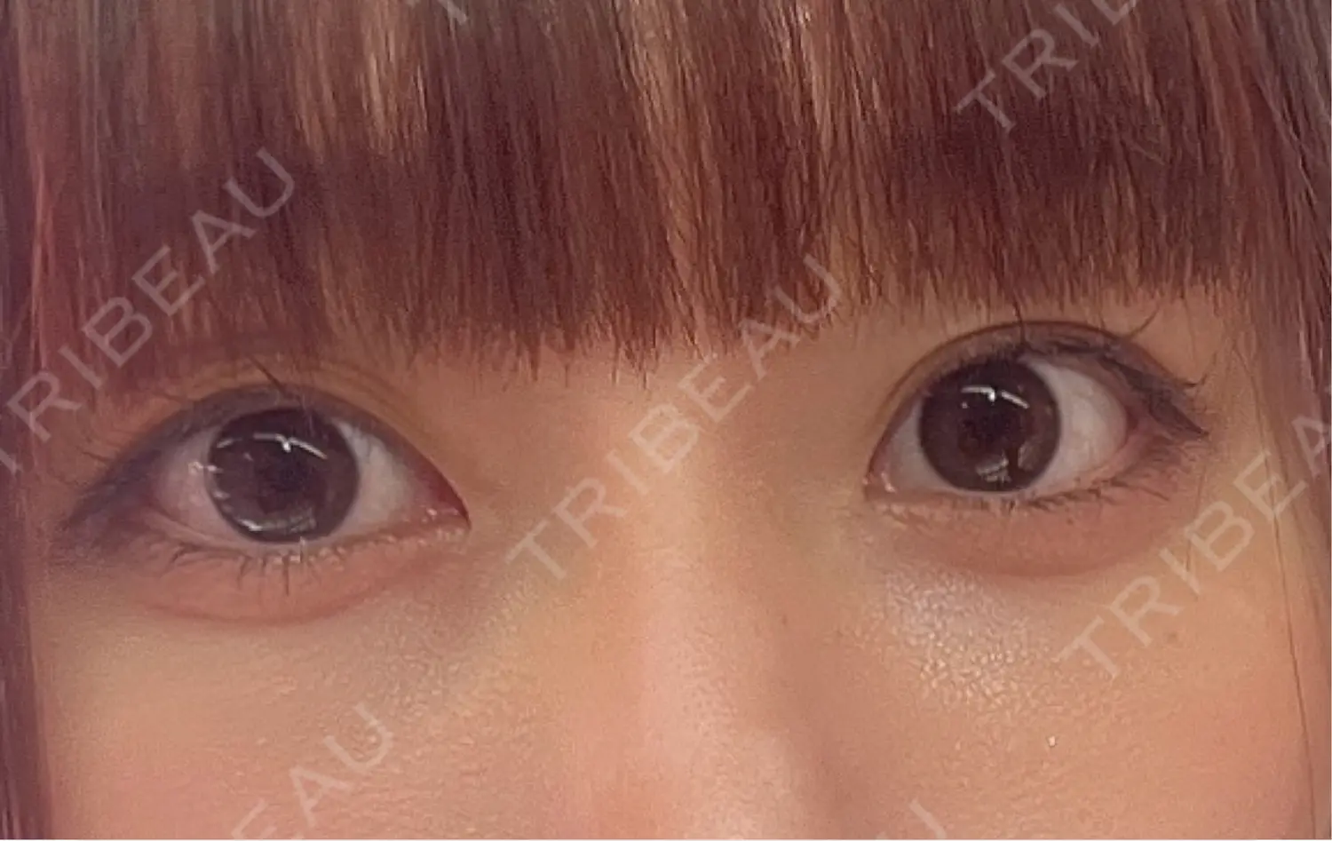 施術前の写真