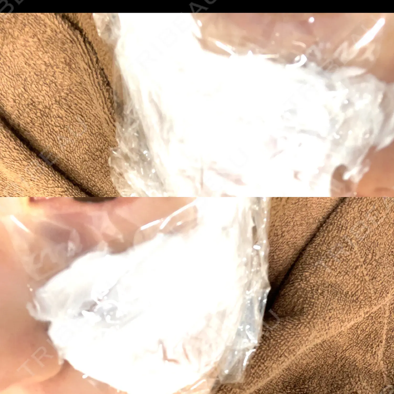 施術前の写真