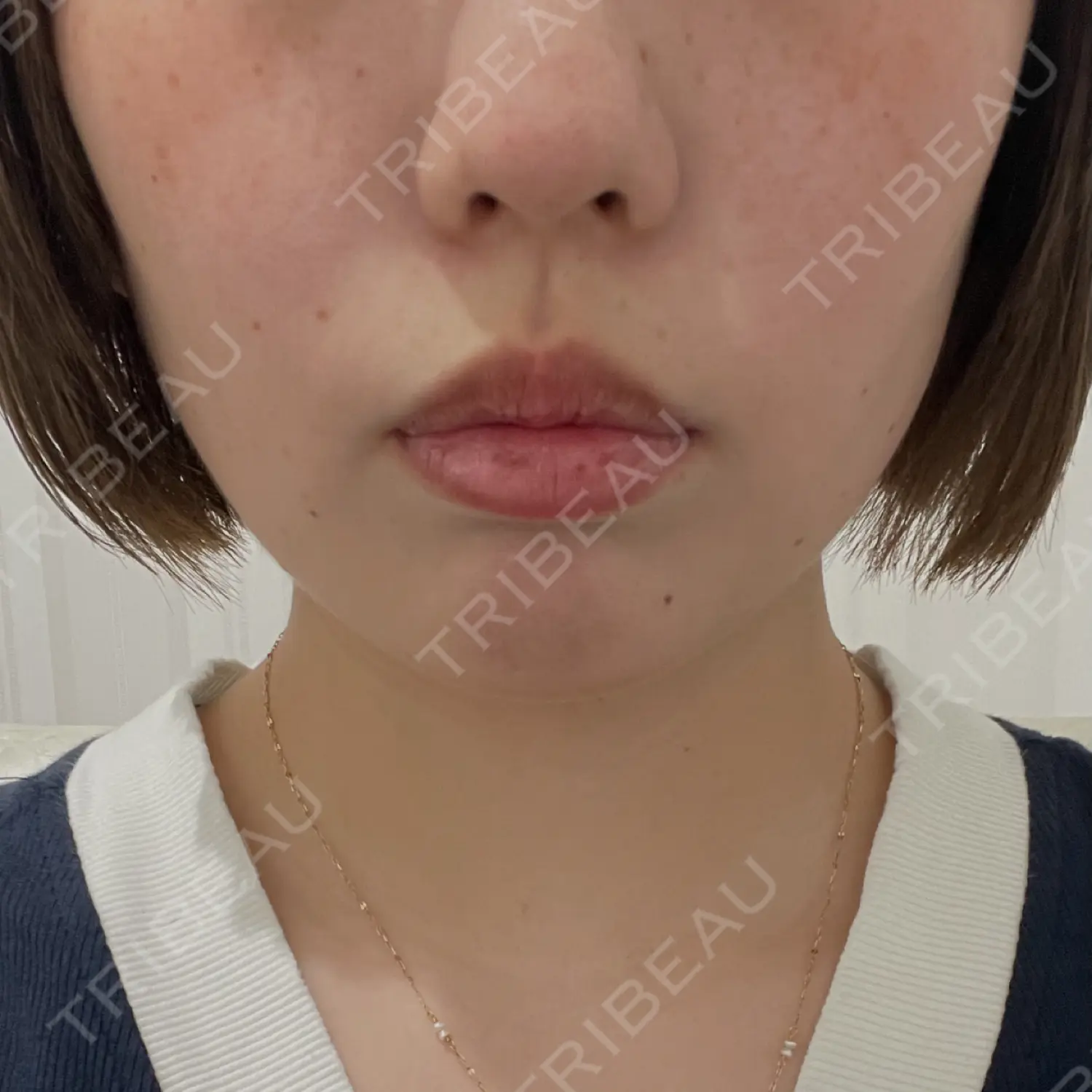 施術前の写真