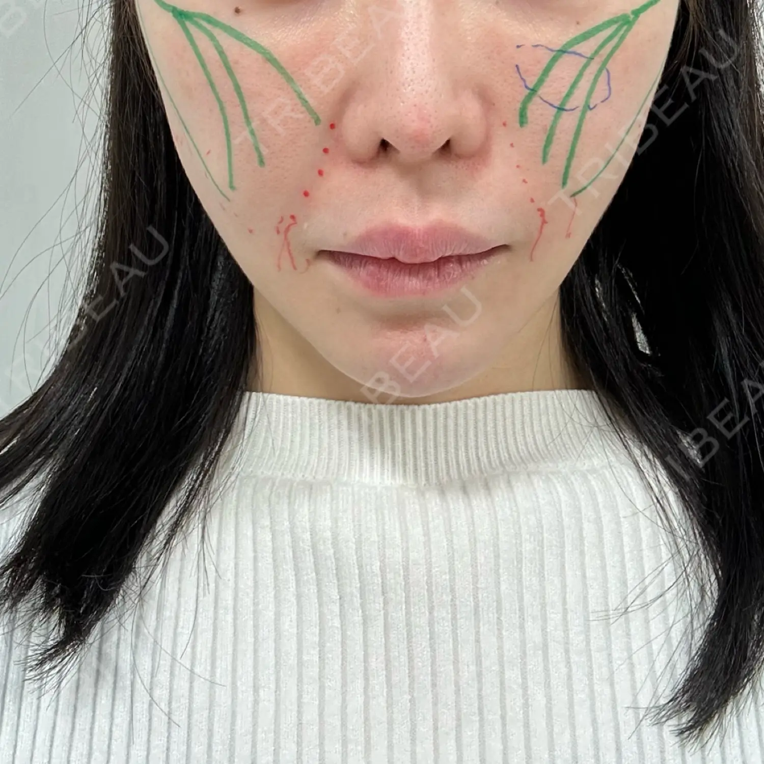 施術前の写真