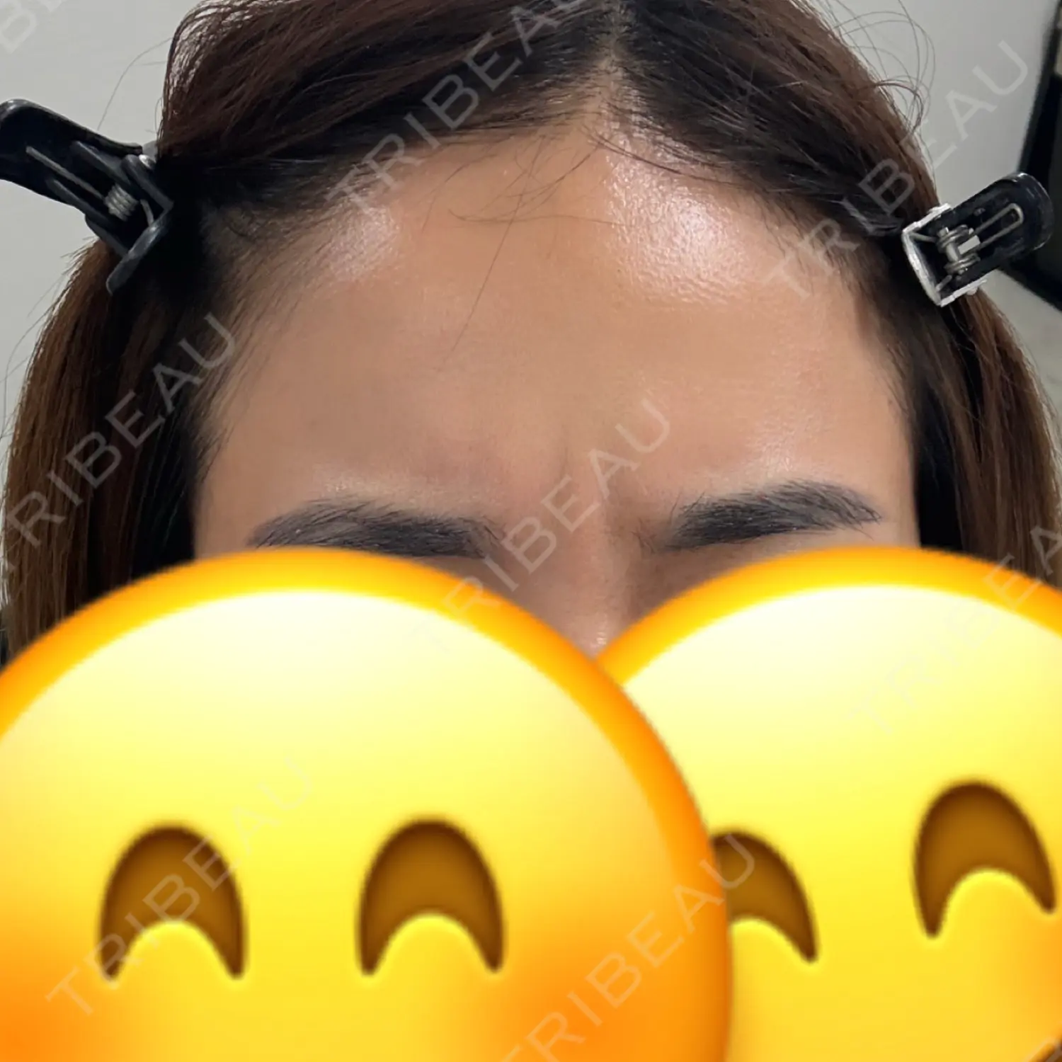 施術前の写真