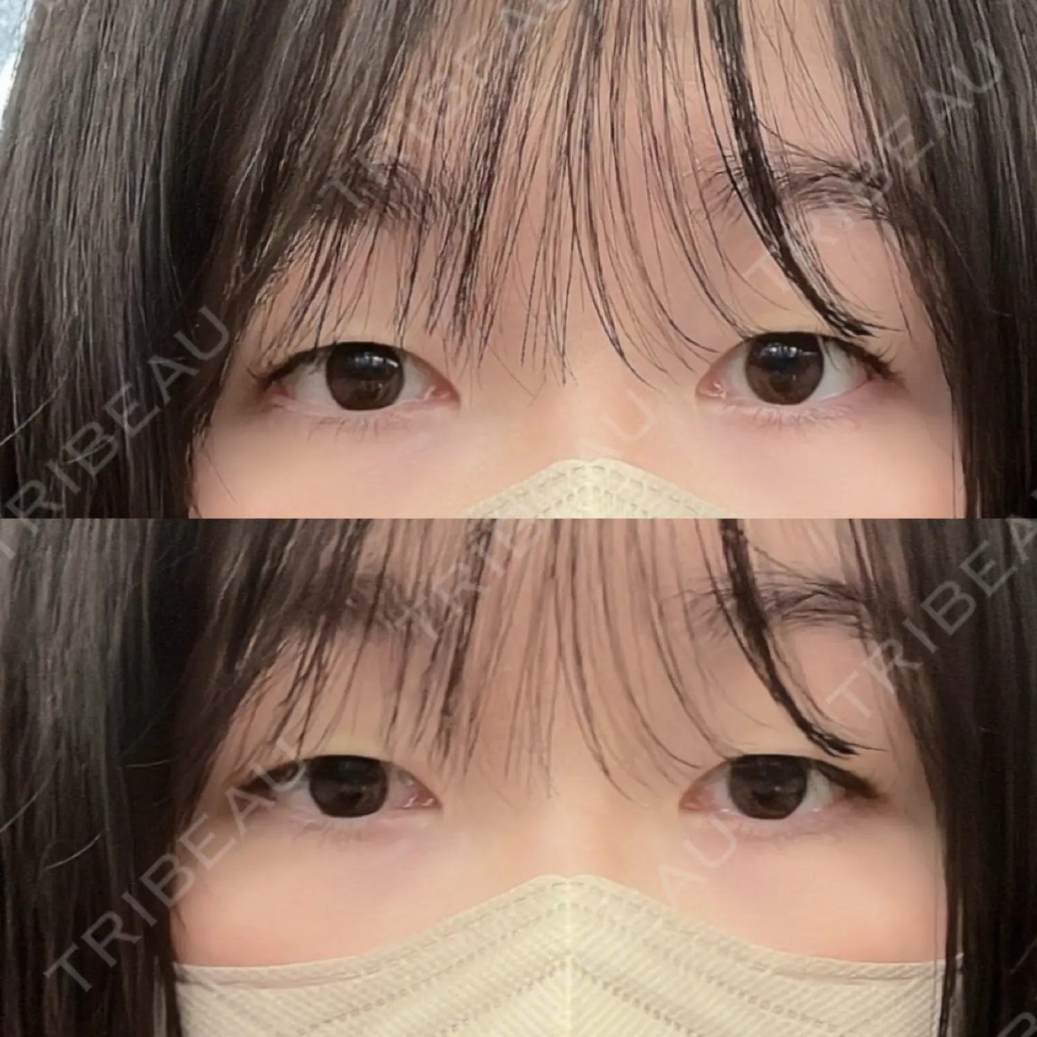 施術前の写真