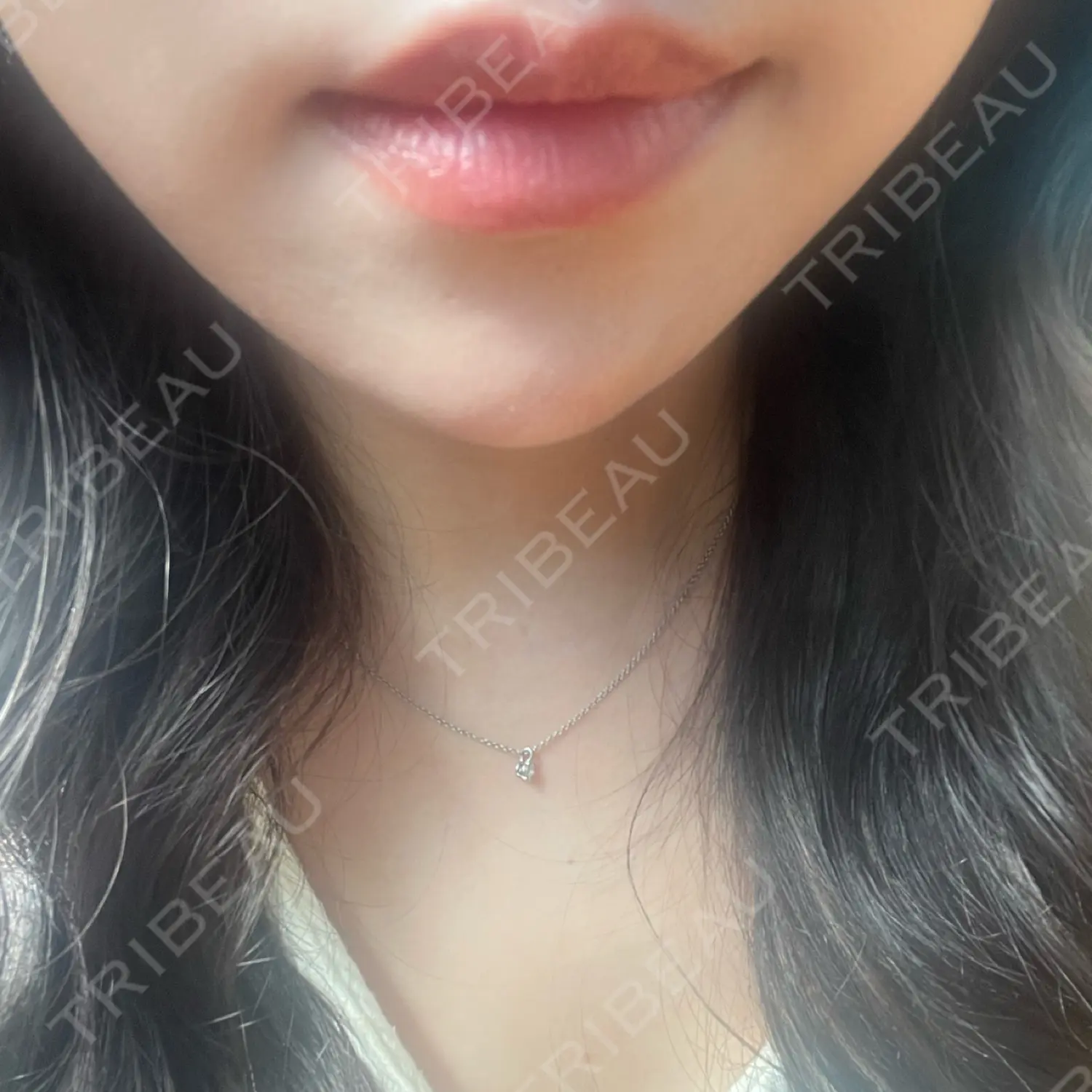 施術前の写真