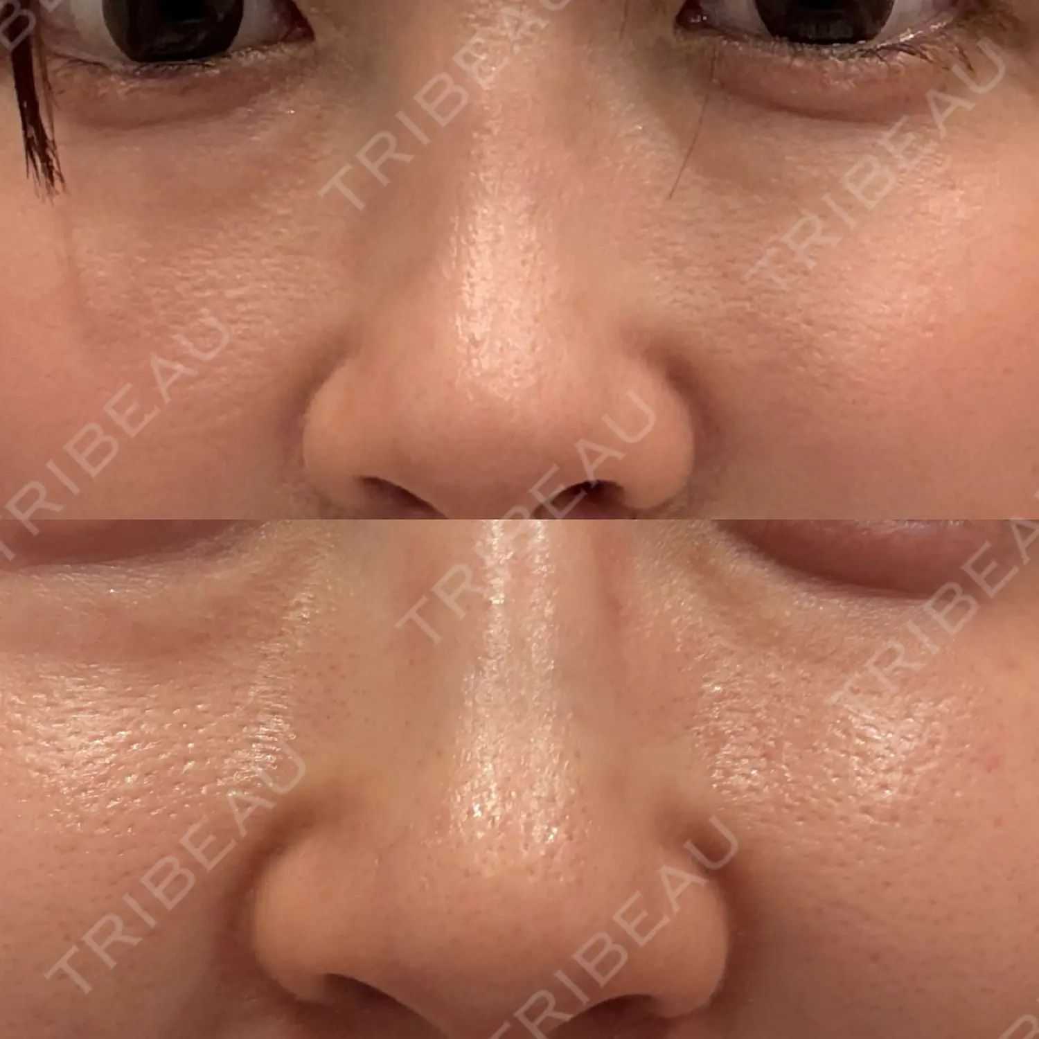 施術前の写真