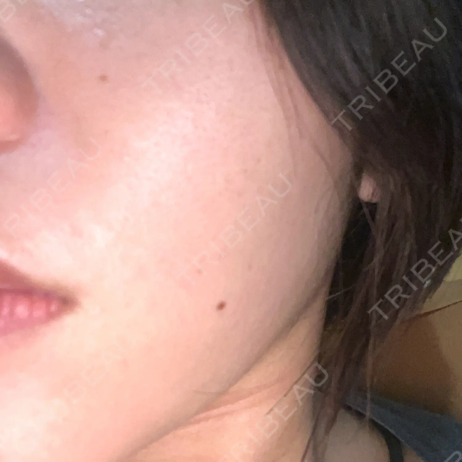 施術前の写真