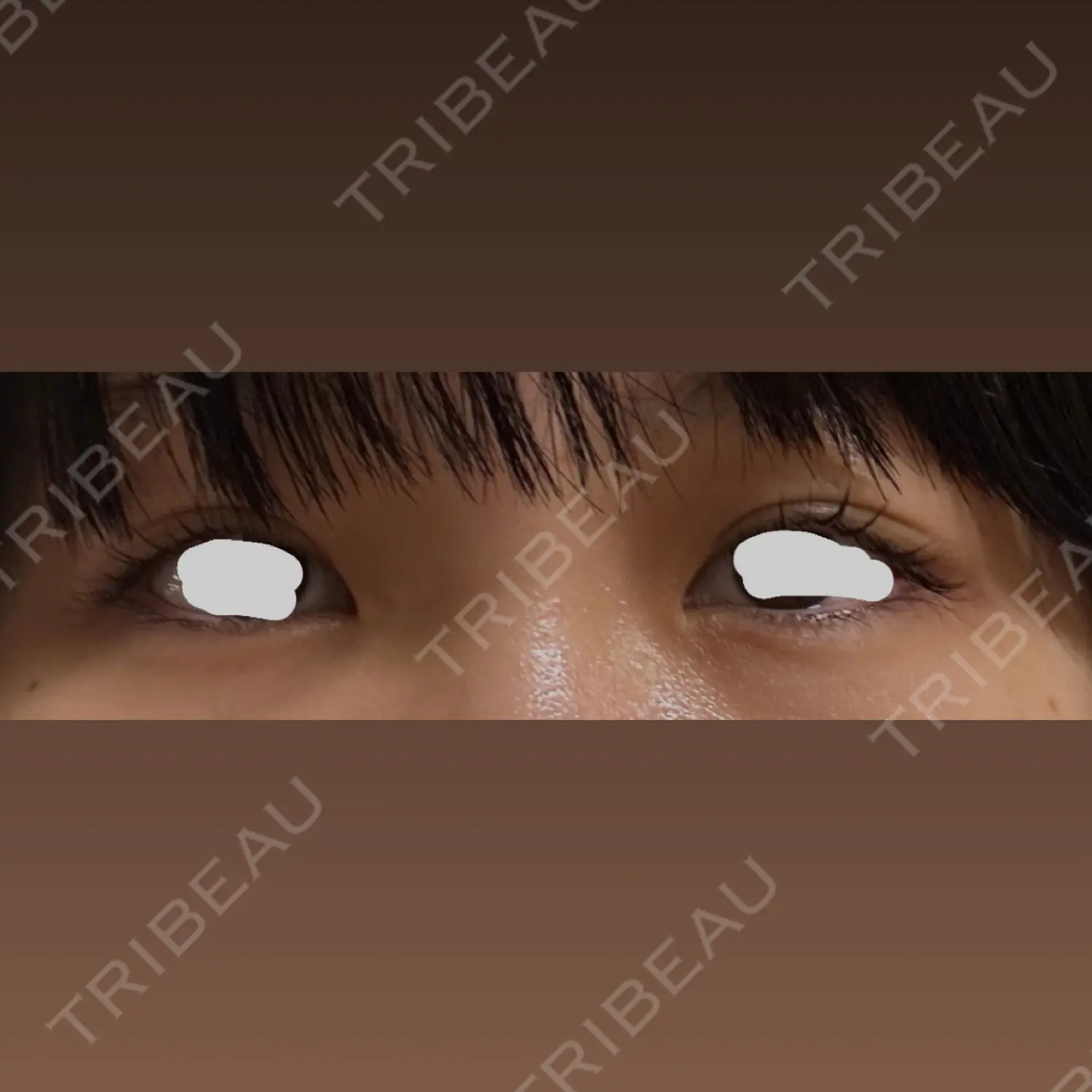 施術前の写真