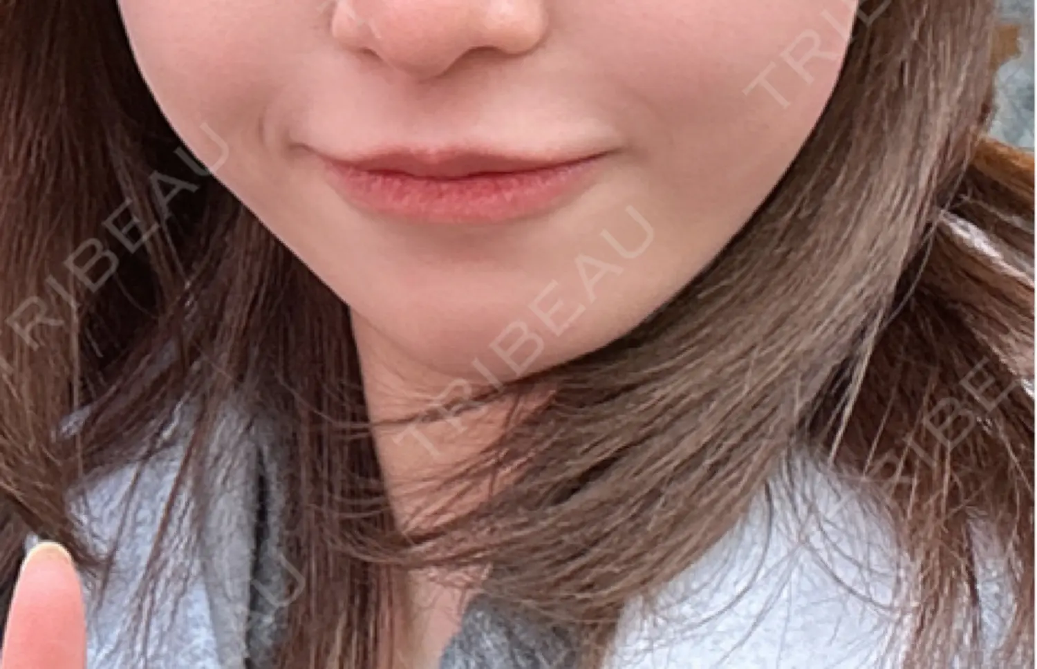 施術前の写真