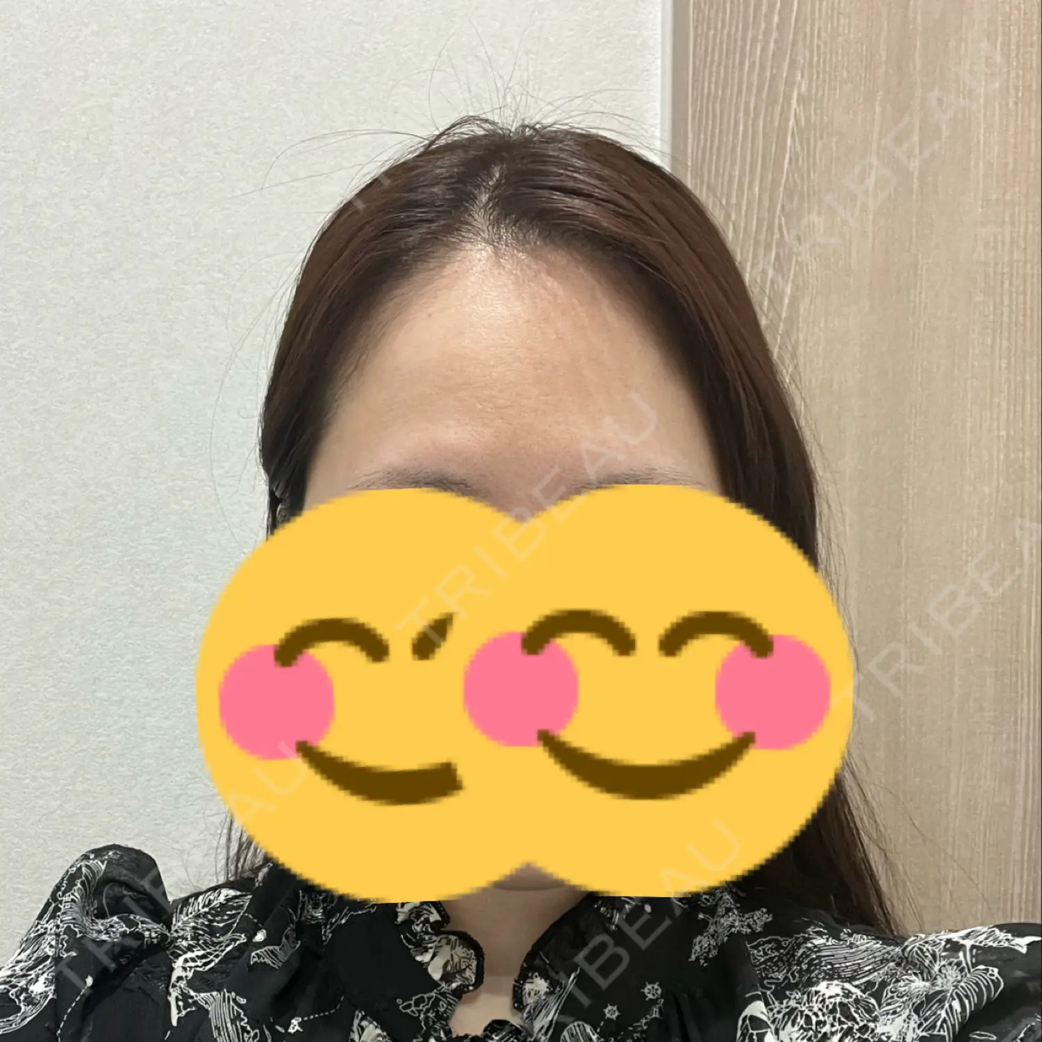 施術前の写真