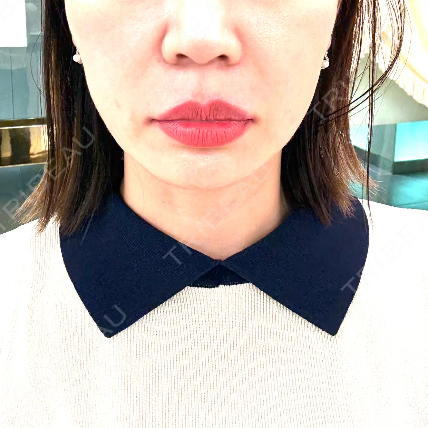 施術前の写真