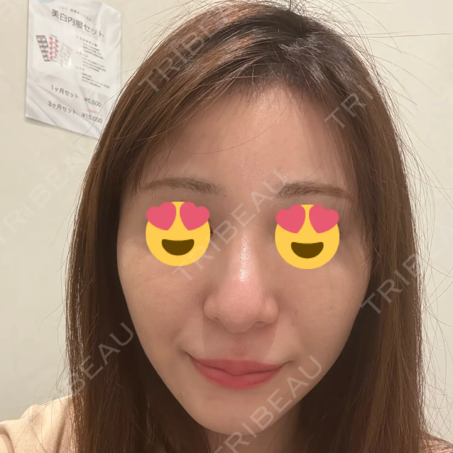 施術前の写真