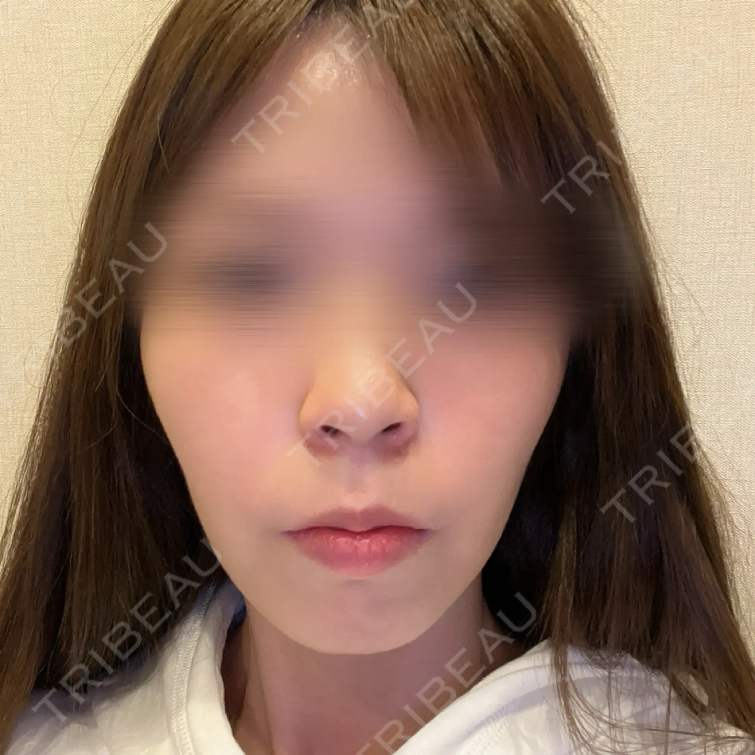 施術前の写真