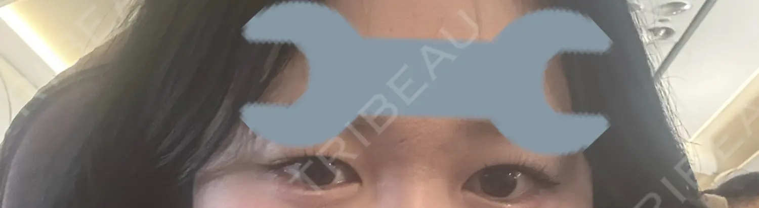 施術前の写真