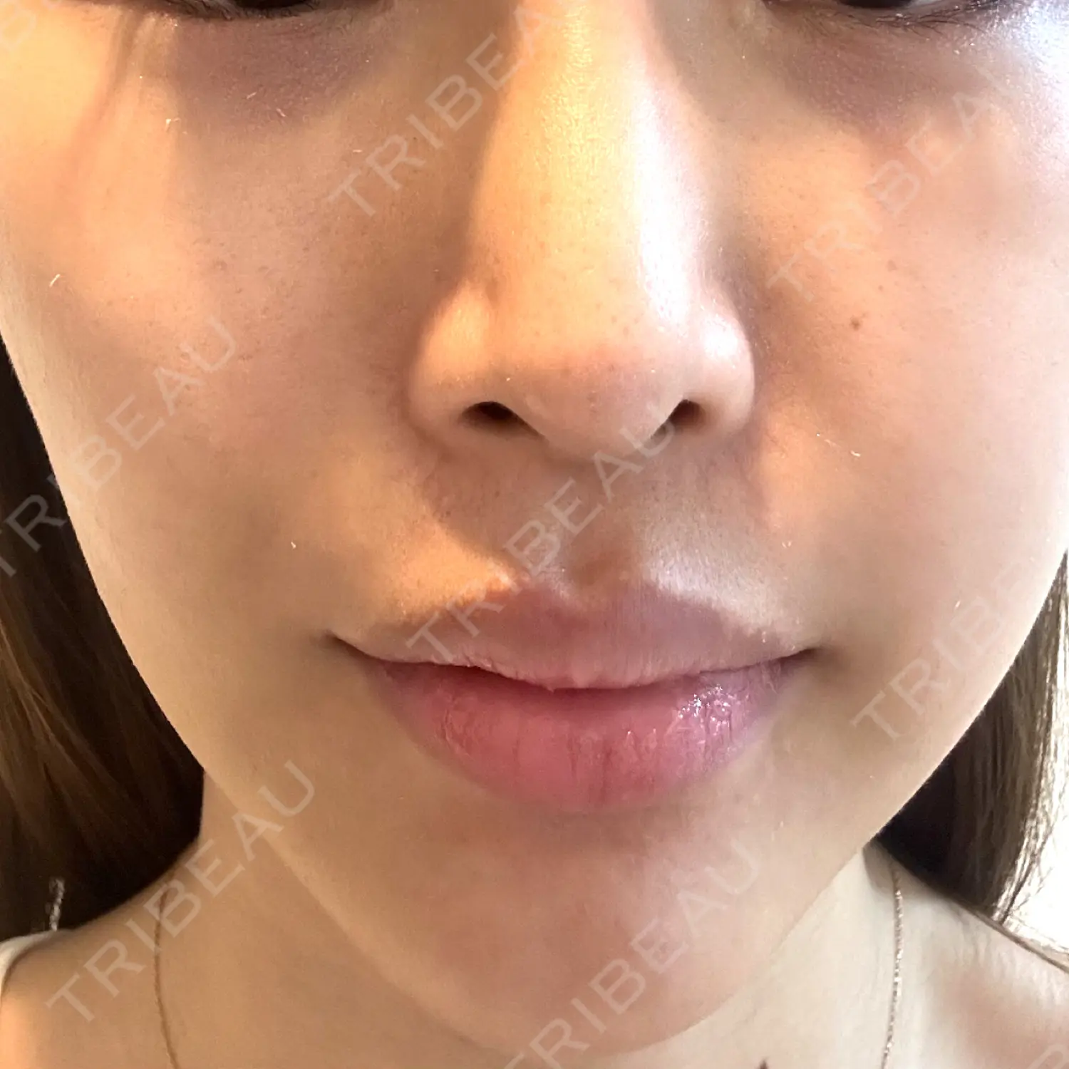 施術前の写真