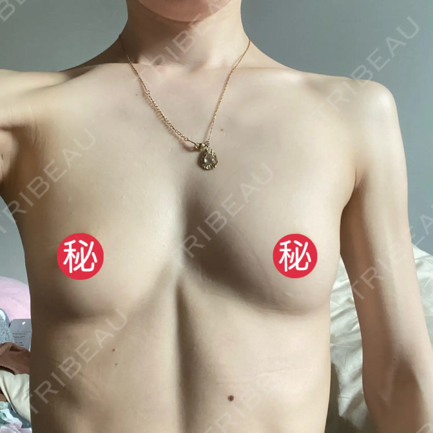 施術前の写真