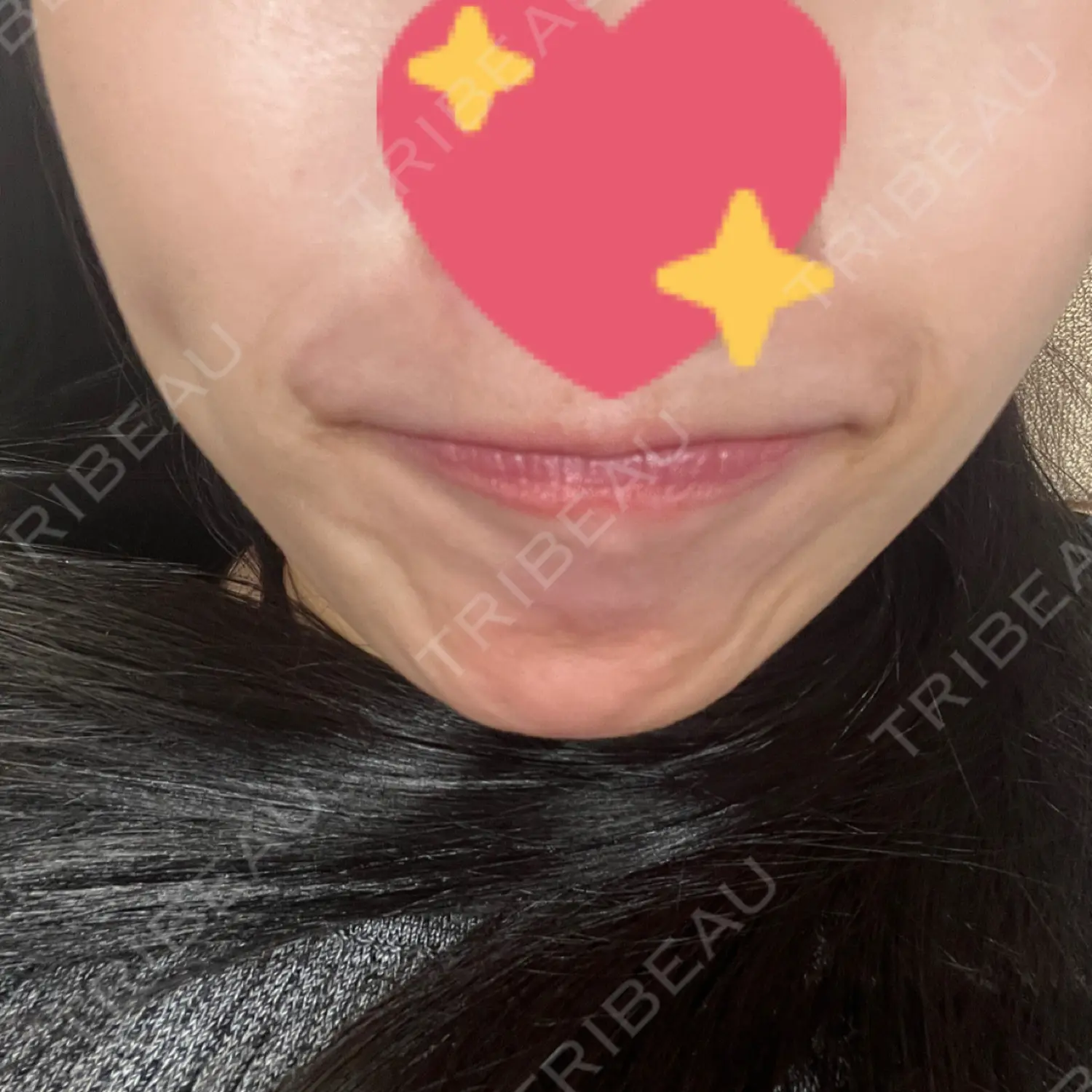 施術前の写真