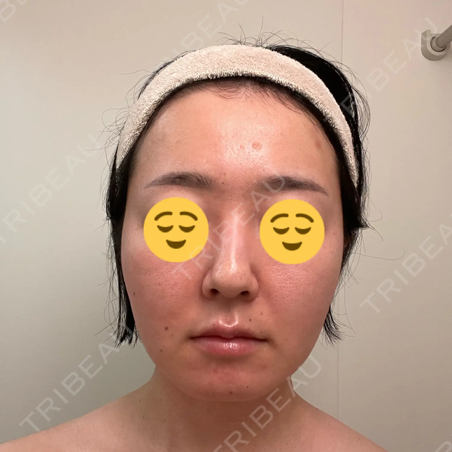 施術前の写真
