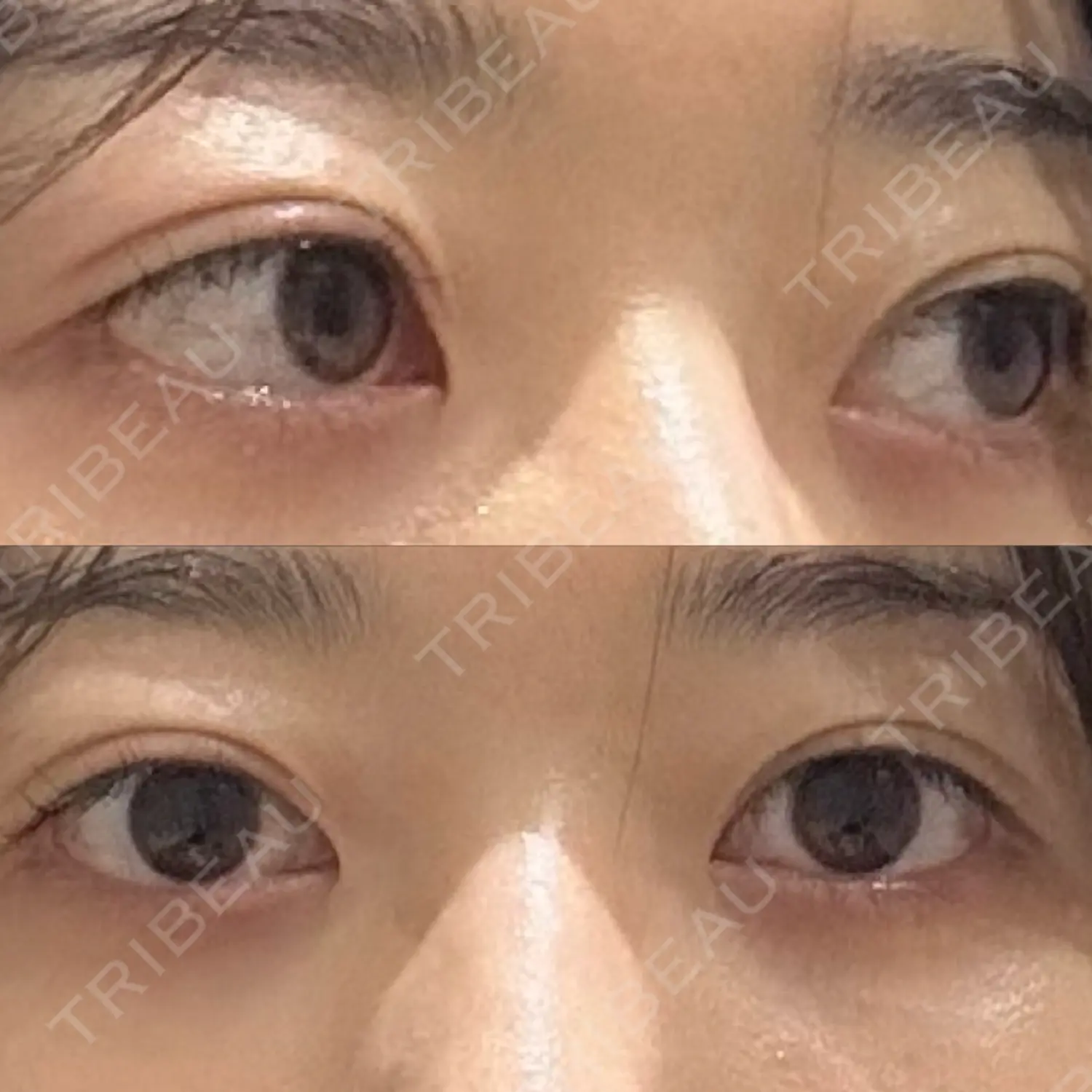 施術前の写真