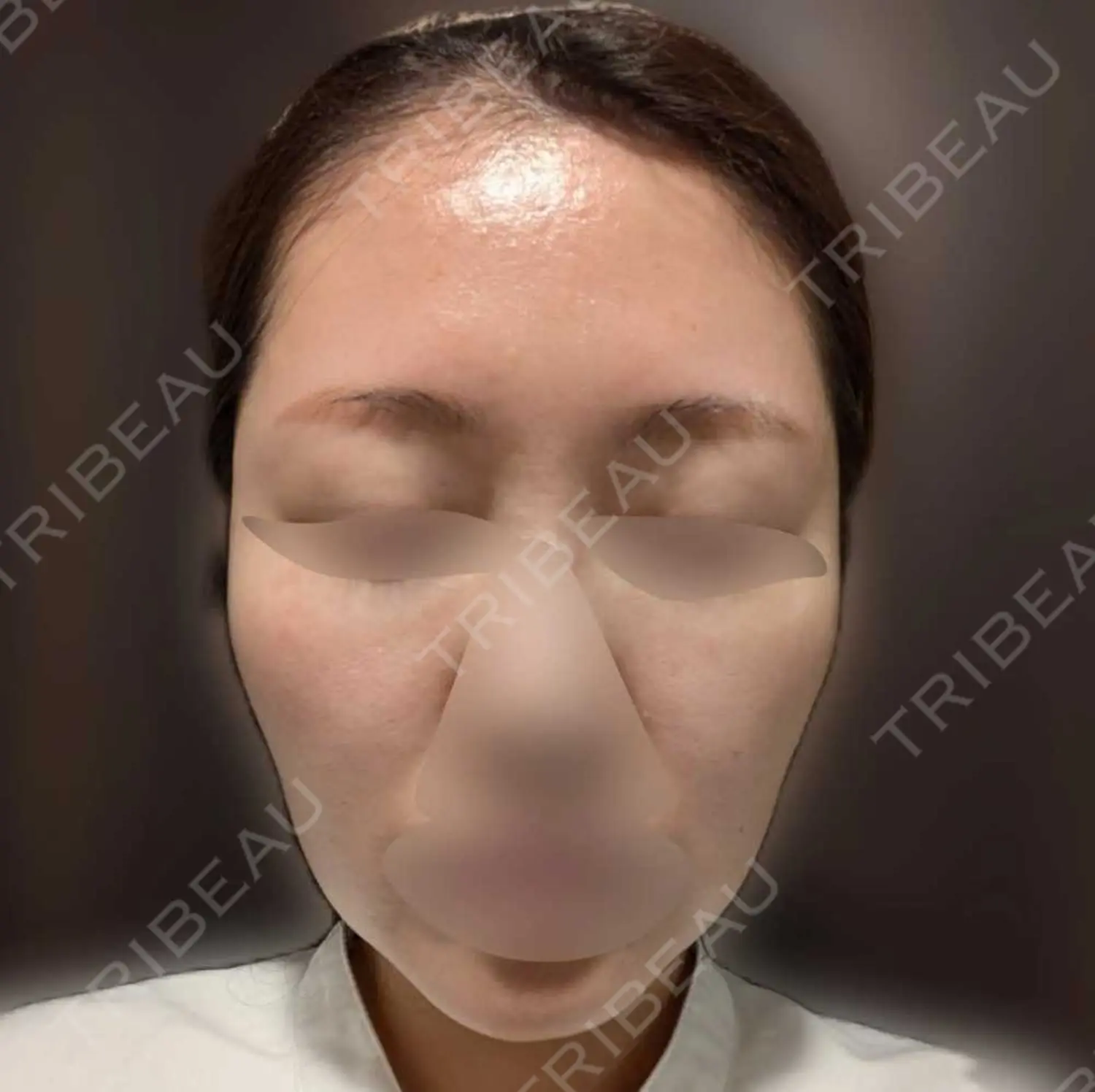 施術前の写真