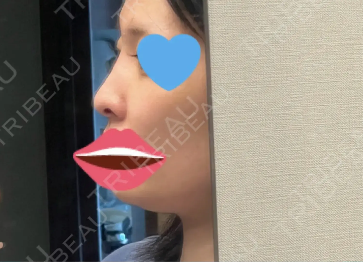 施術前の写真