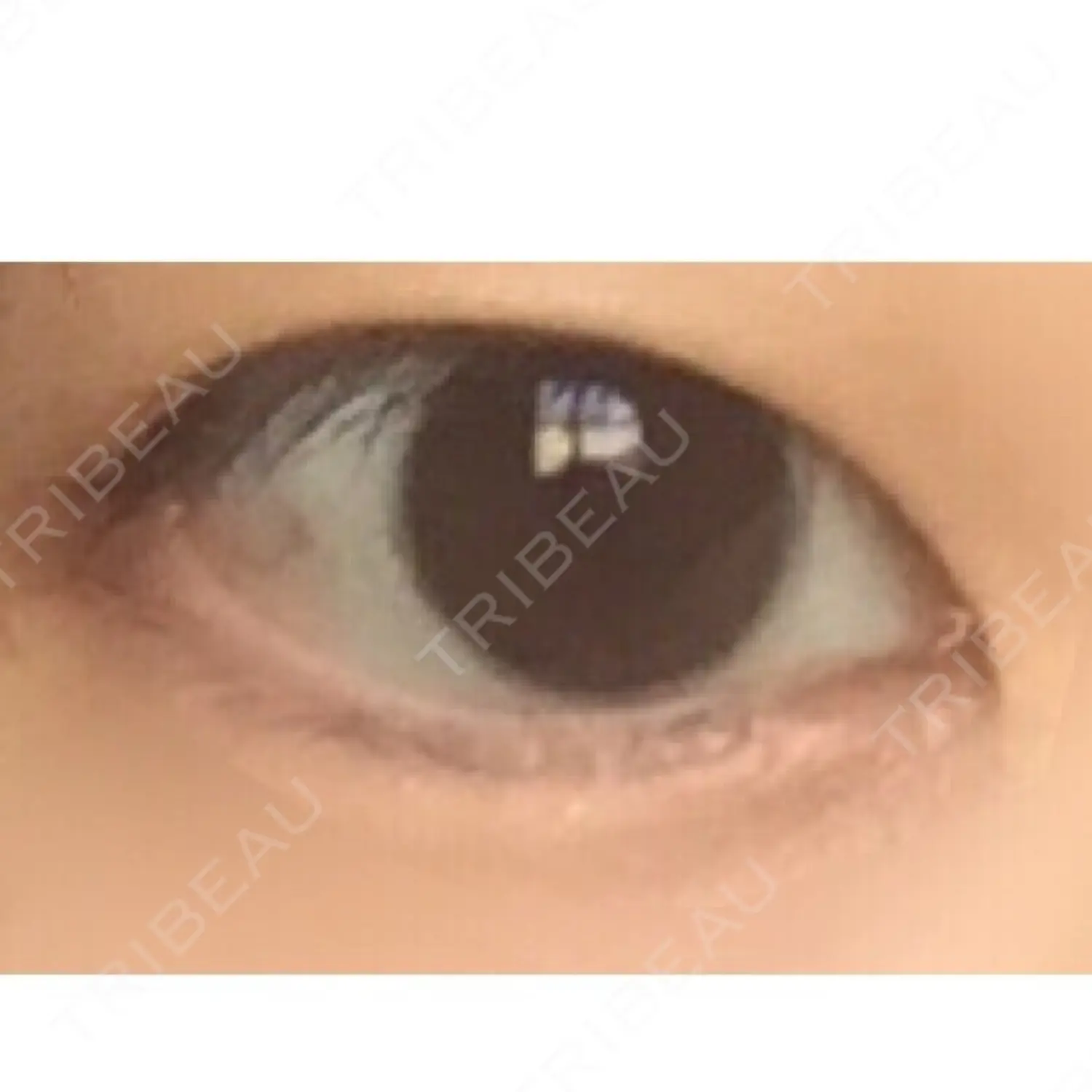 施術前の写真