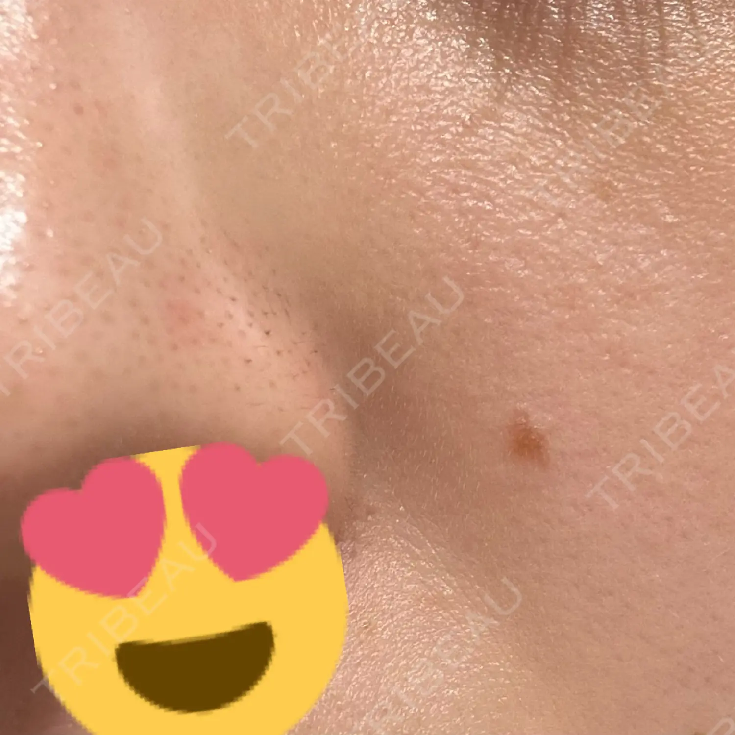 施術前の写真