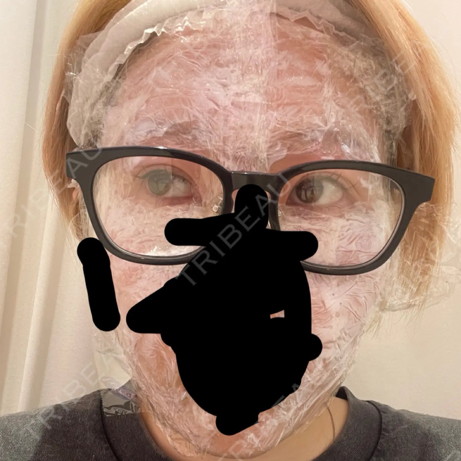 施術前の写真