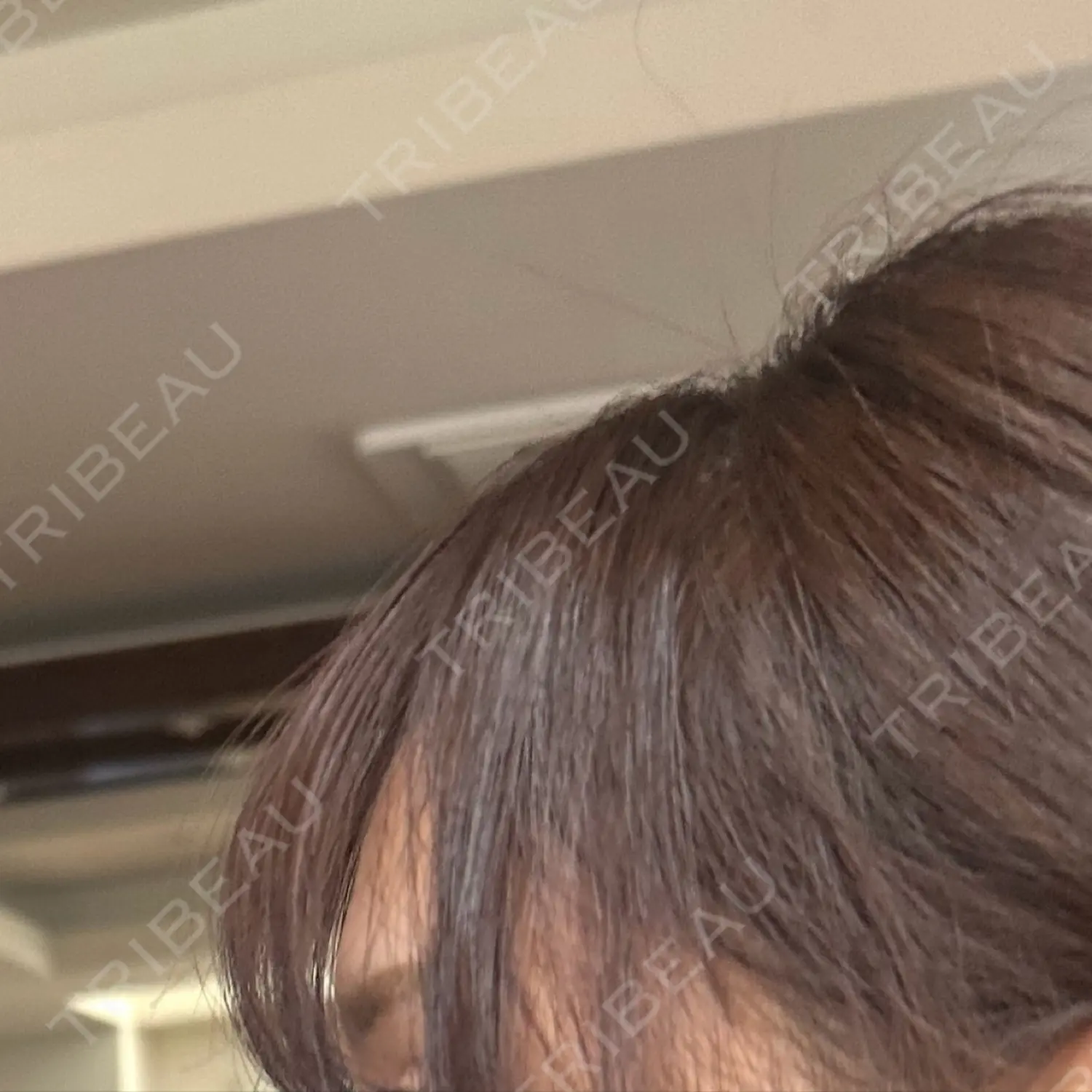 施術前の写真