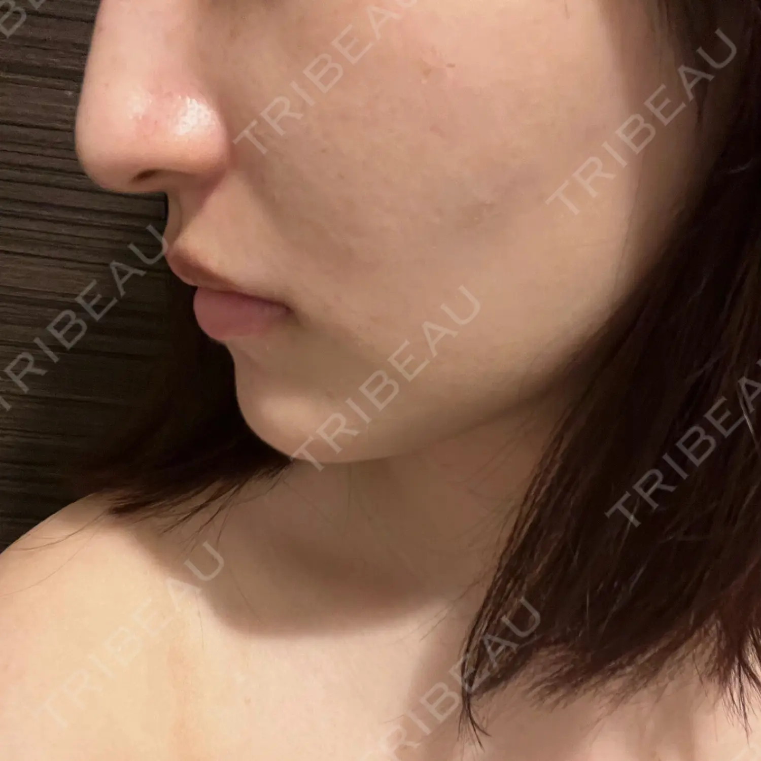 施術前の写真