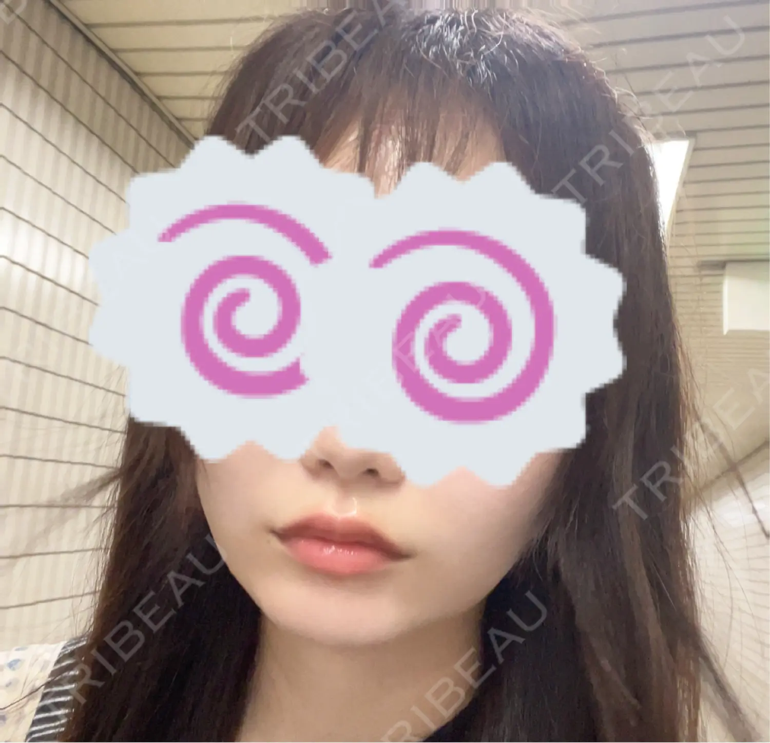 施術前の写真