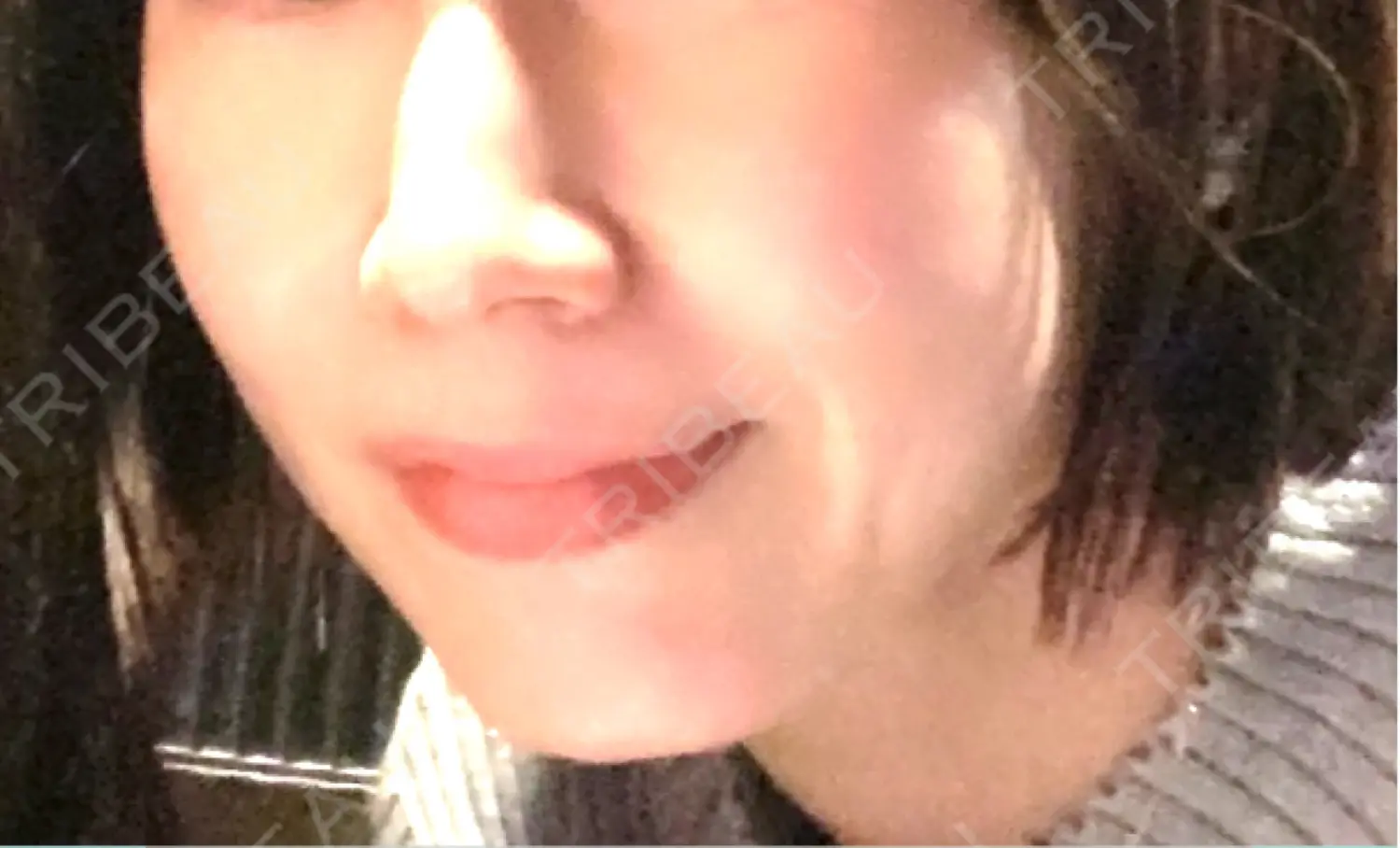 施術前の写真