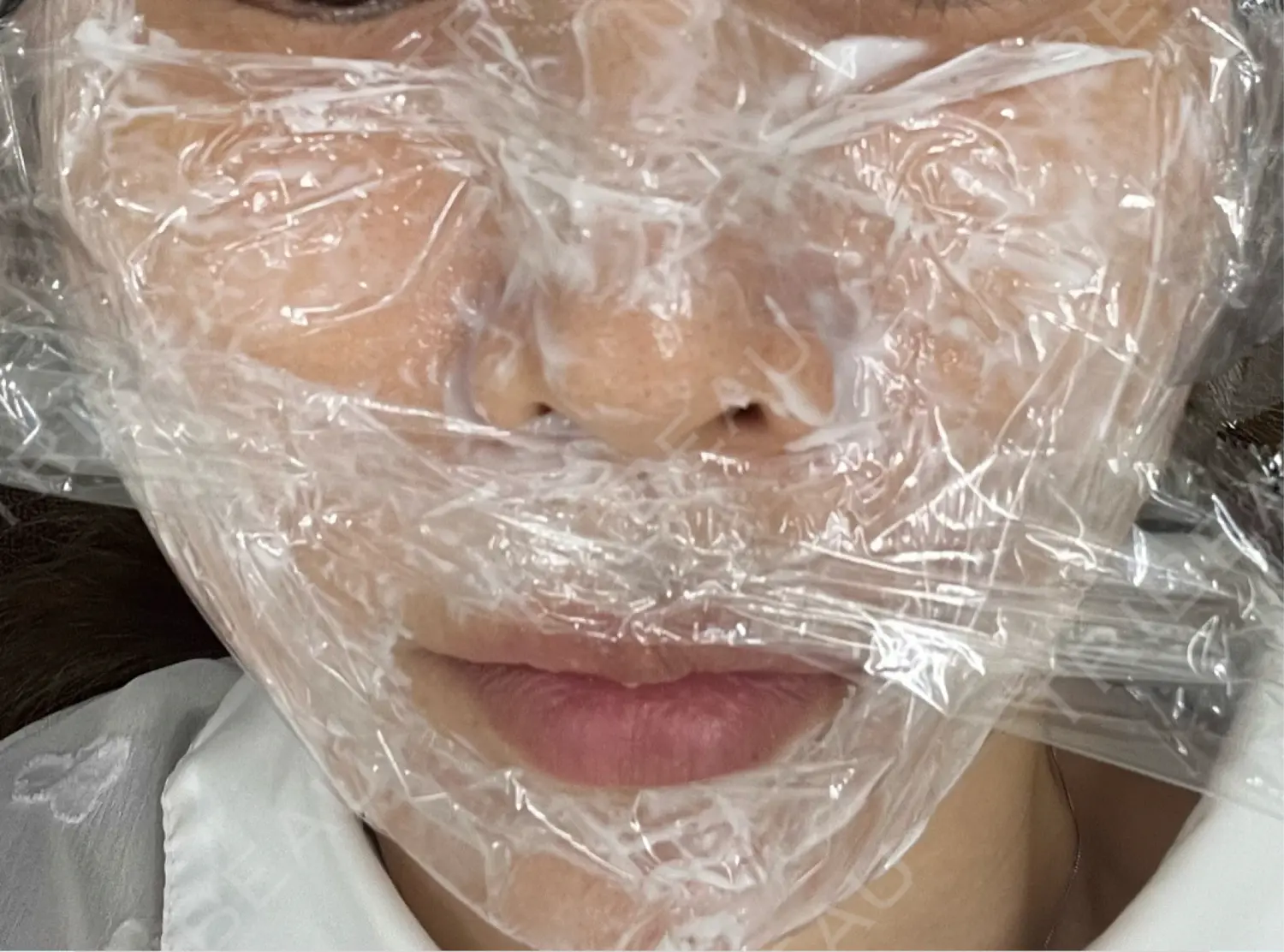 施術前の写真