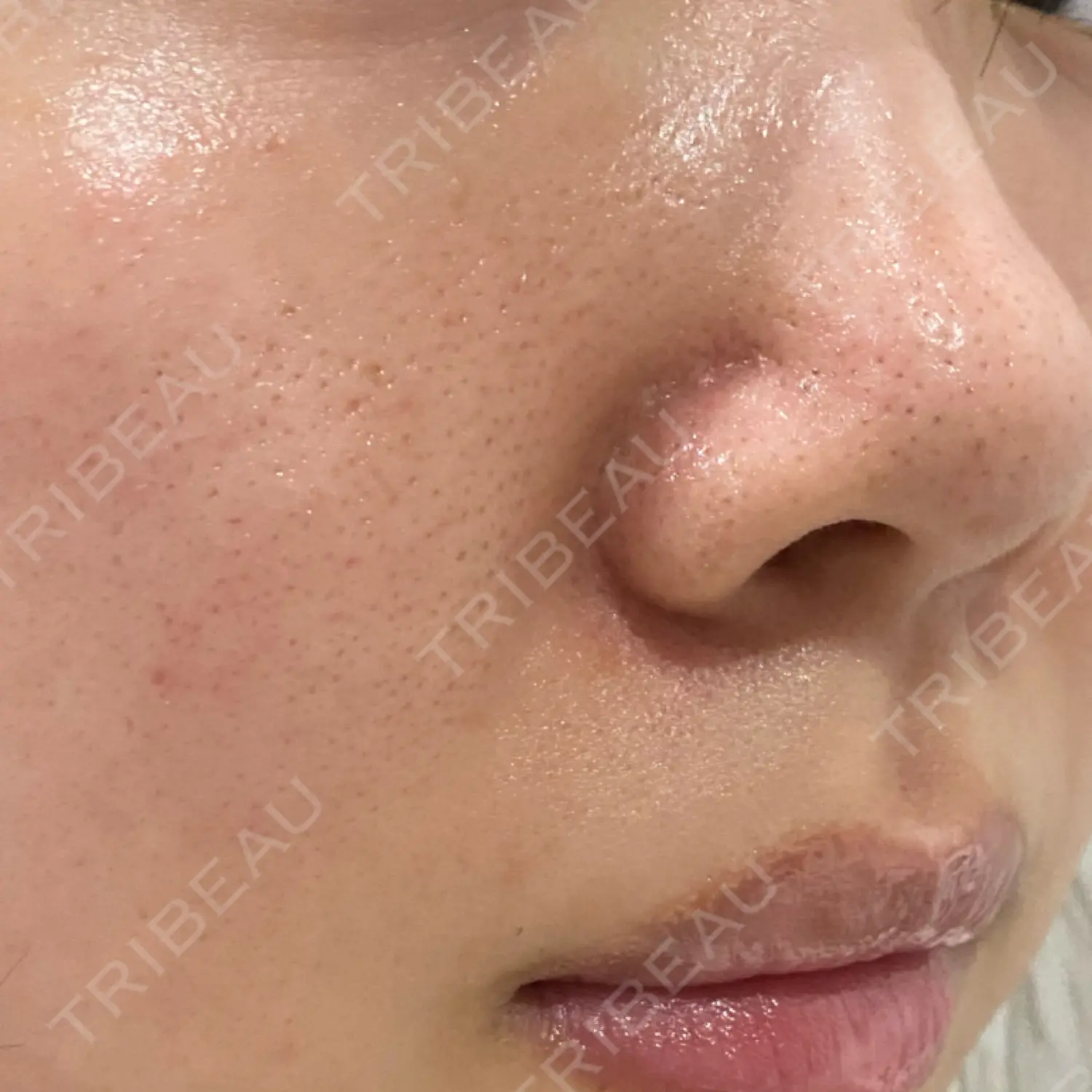 施術前の写真