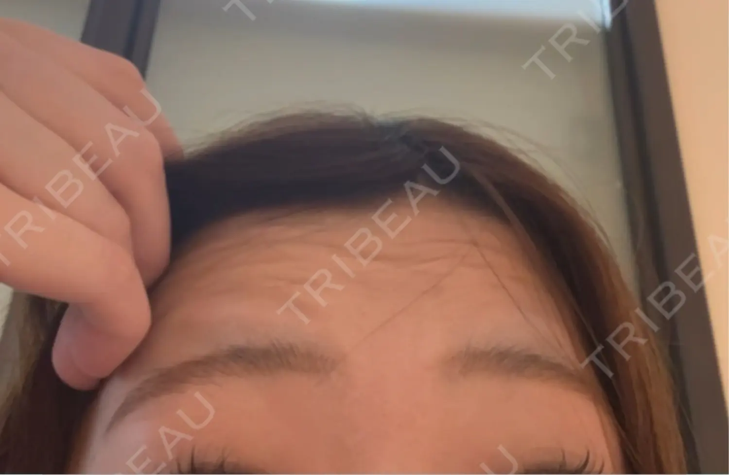 施術前の写真