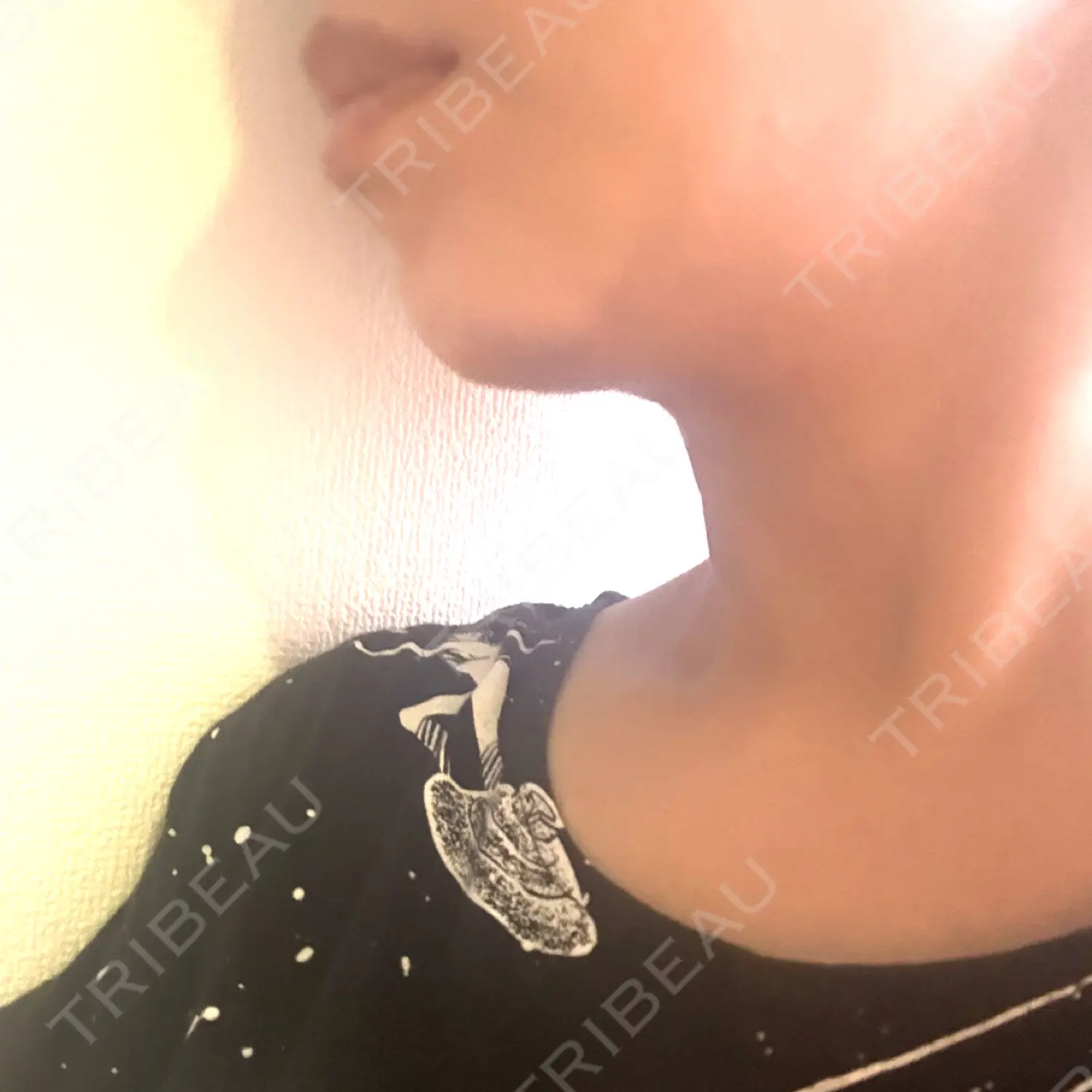 施術前の写真