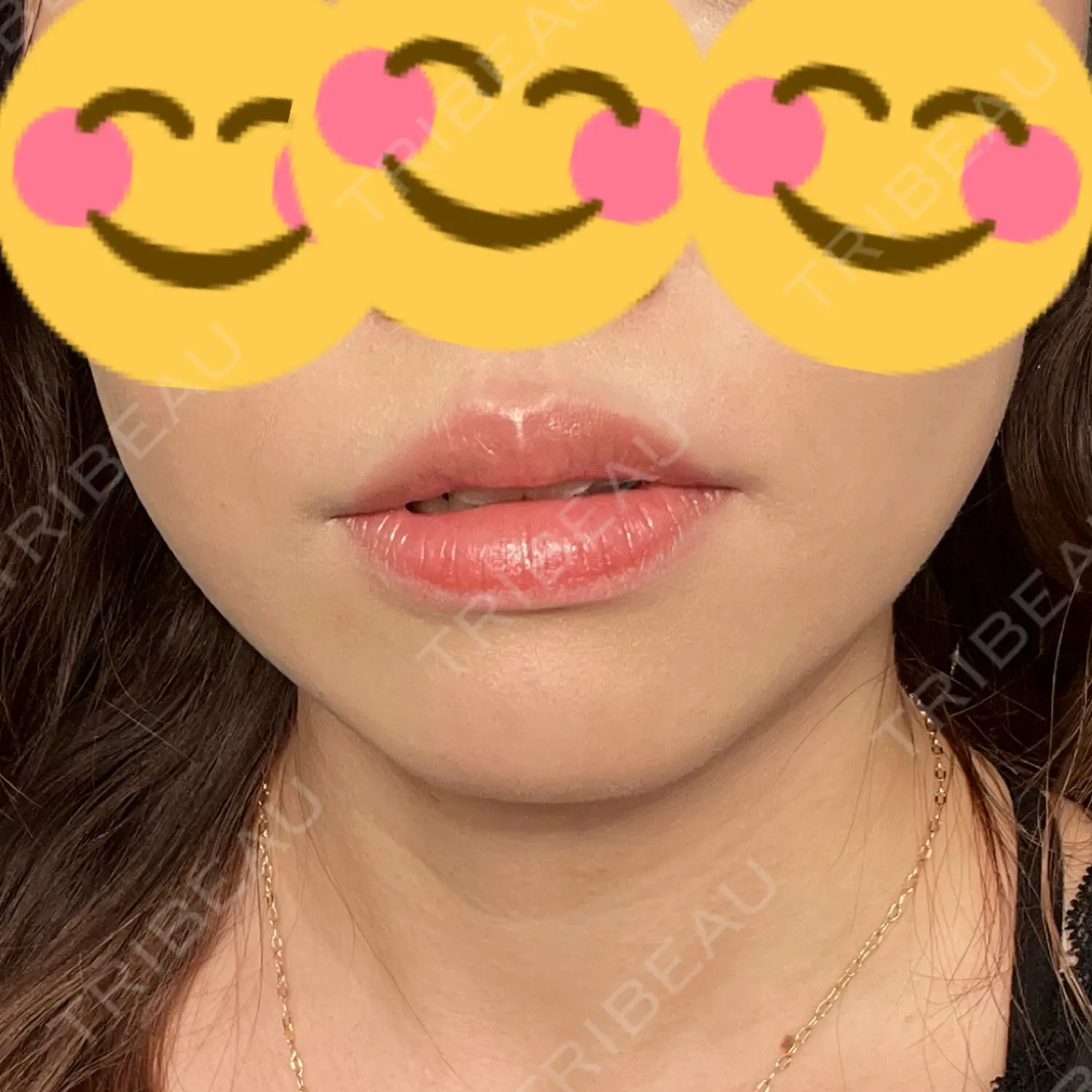 施術前の写真