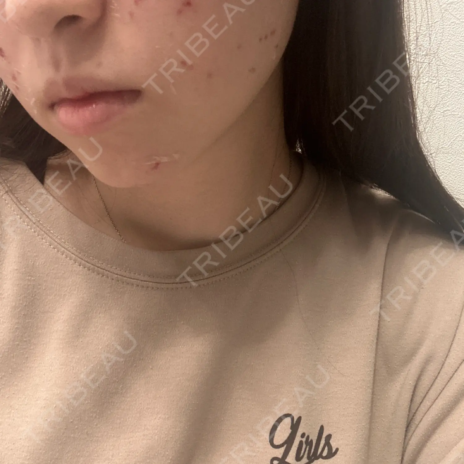 施術前の写真