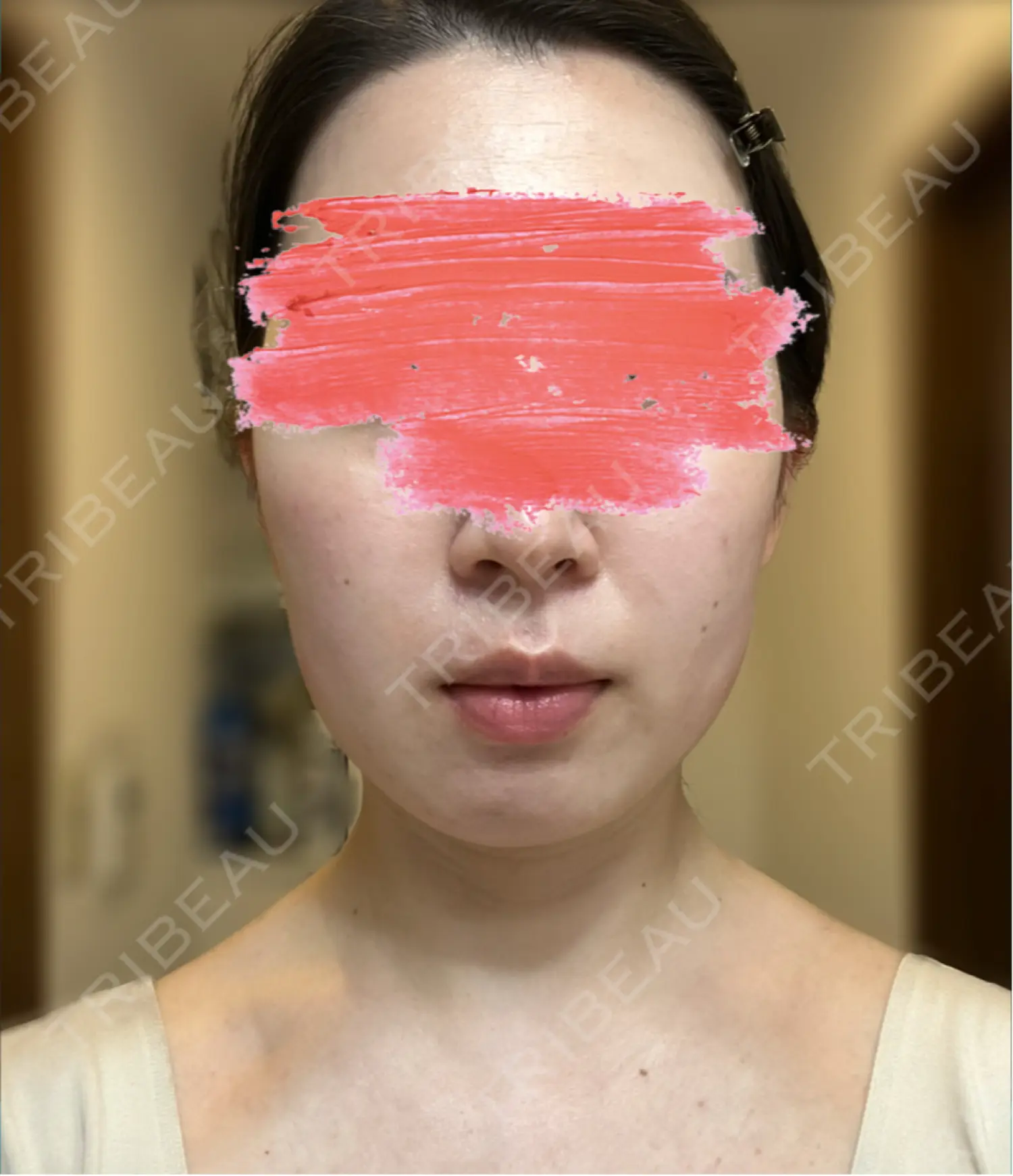 施術前の写真