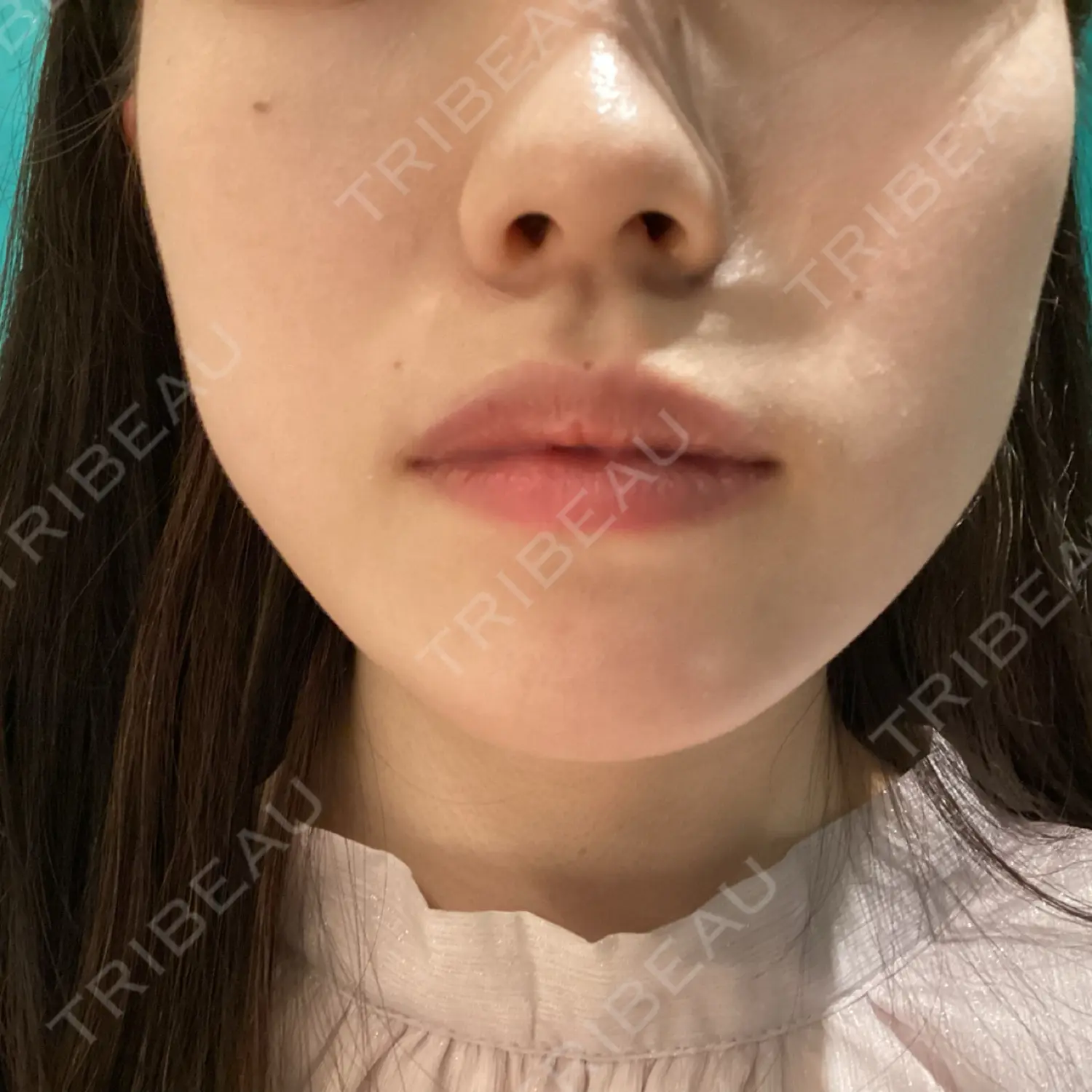 施術前の写真