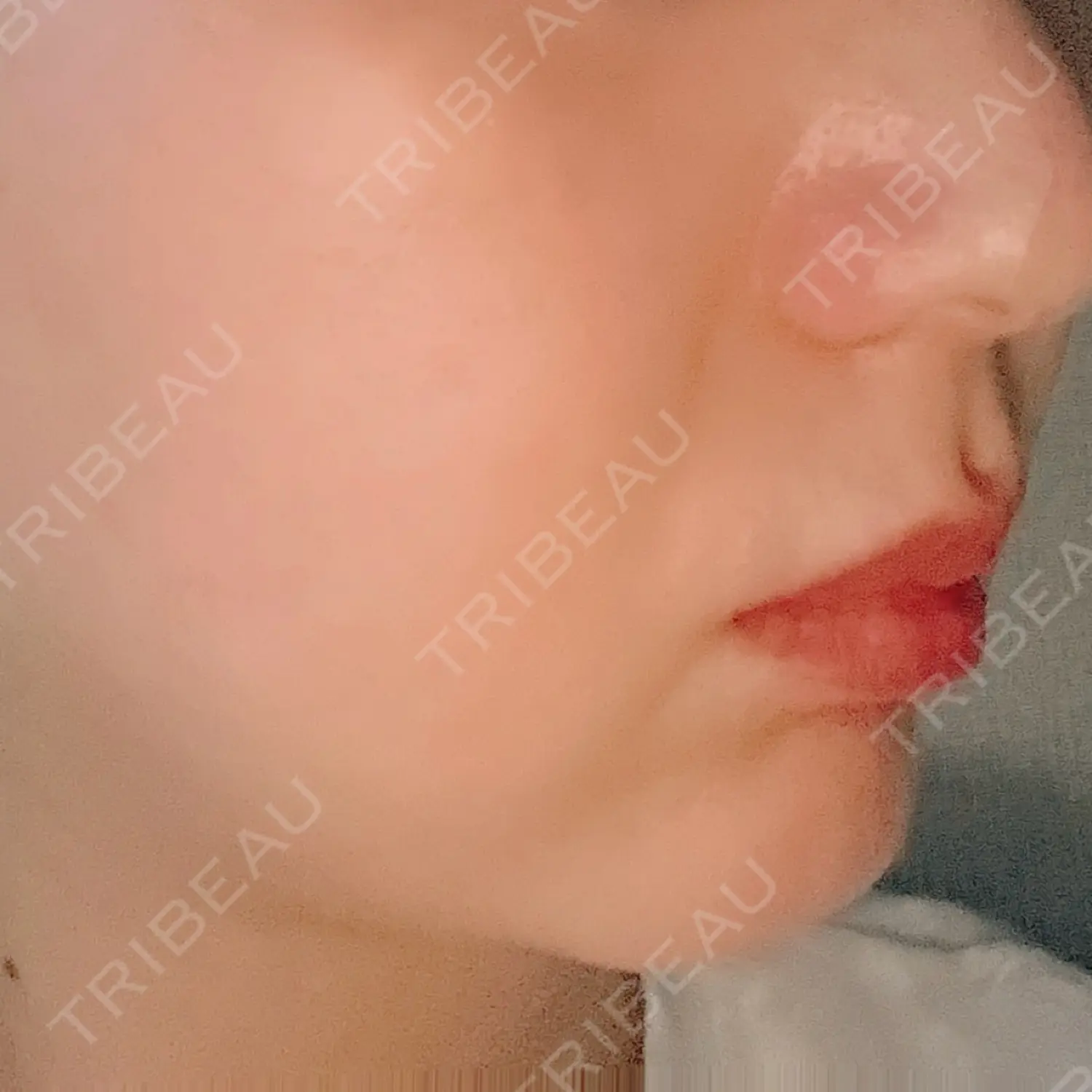 施術前の写真