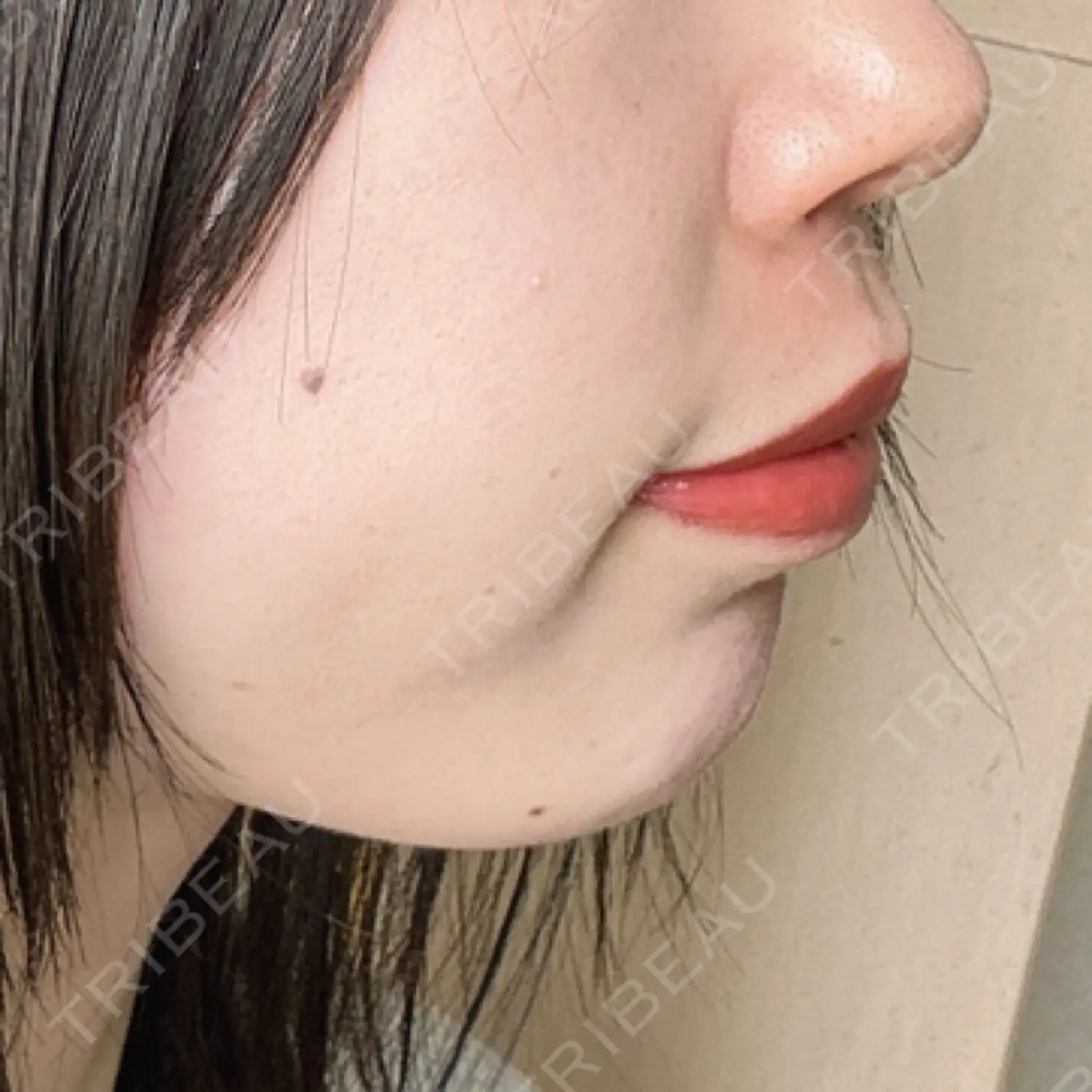 施術前の写真