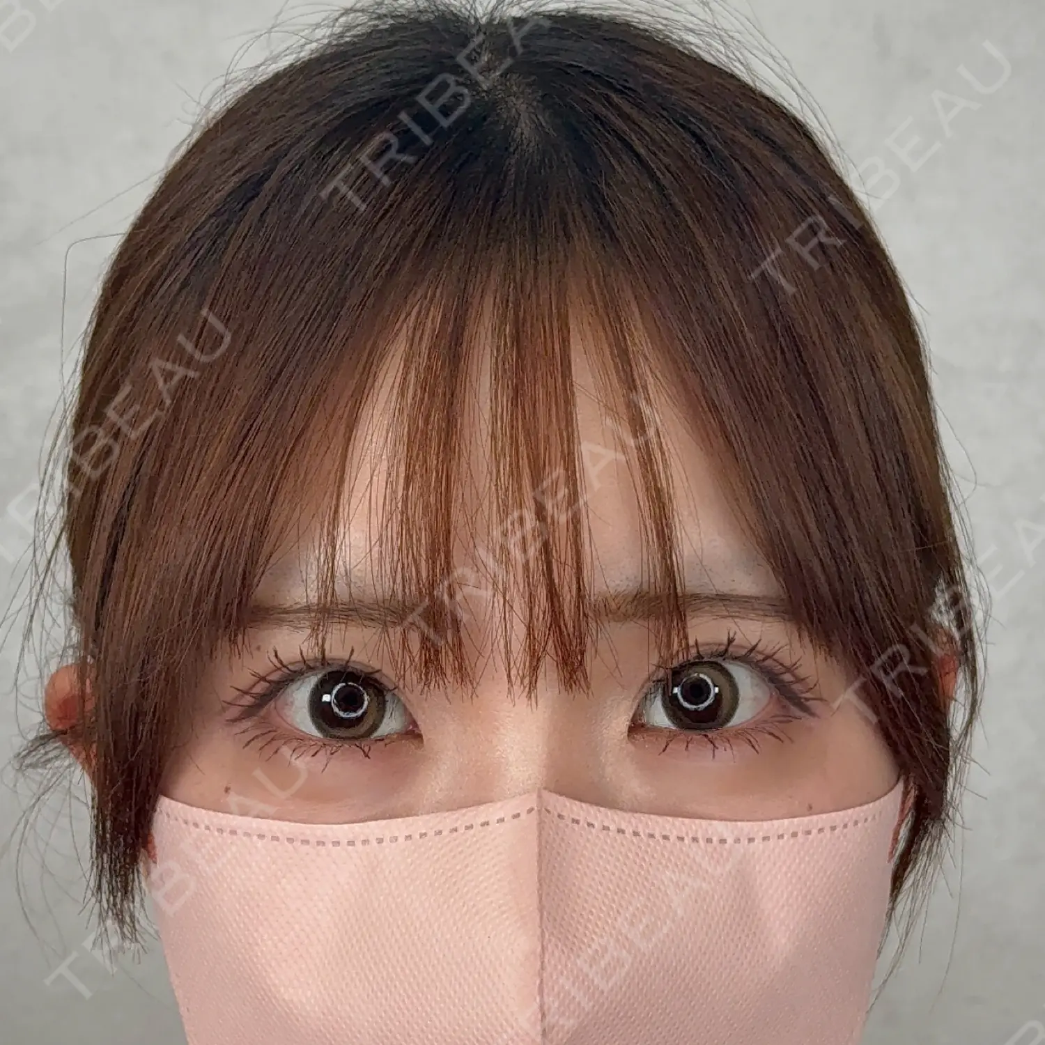 施術前の写真
